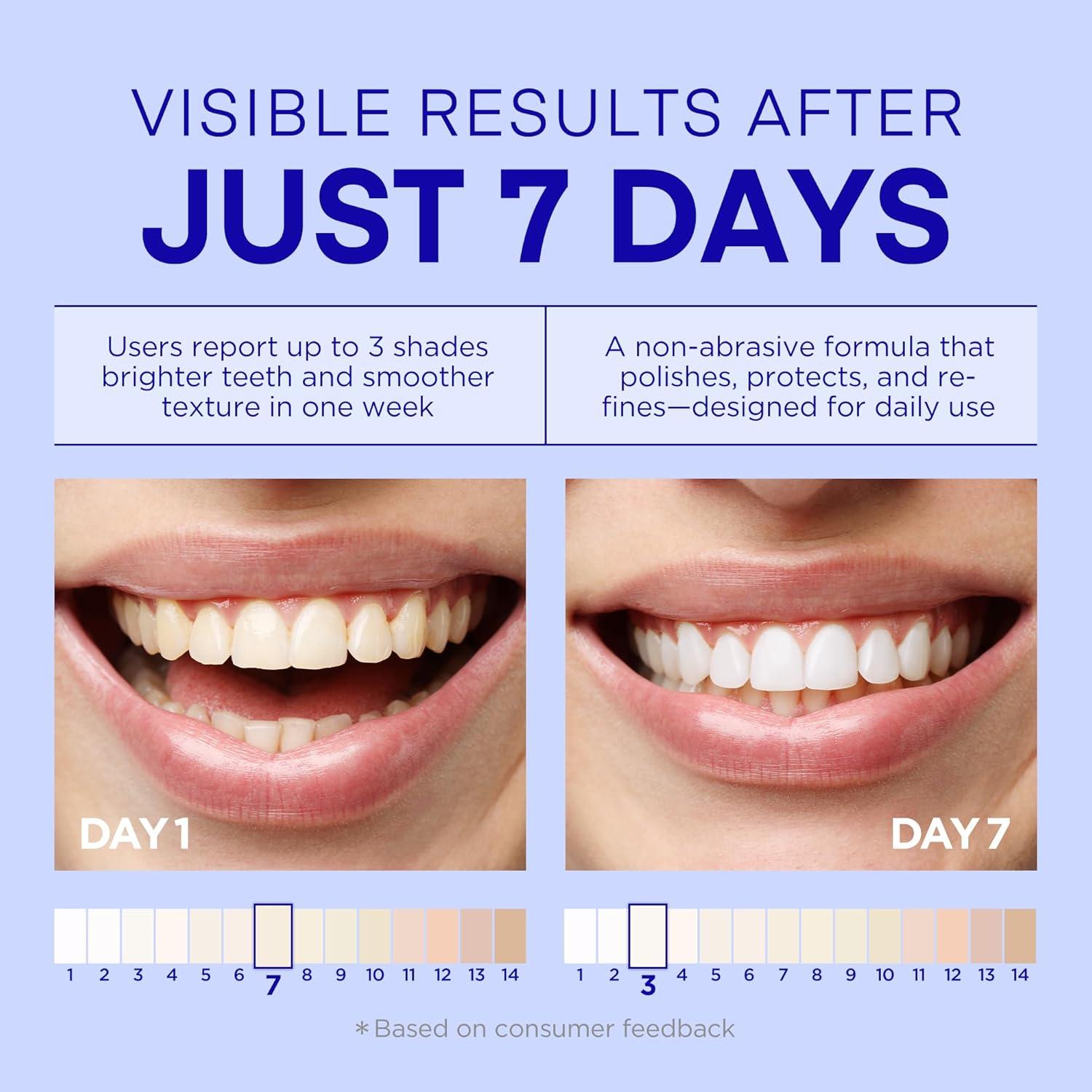 Pasta de Dientes Blanqueadora PearlSmile 120g - Niacinamida y Nano Hidroxiapatita