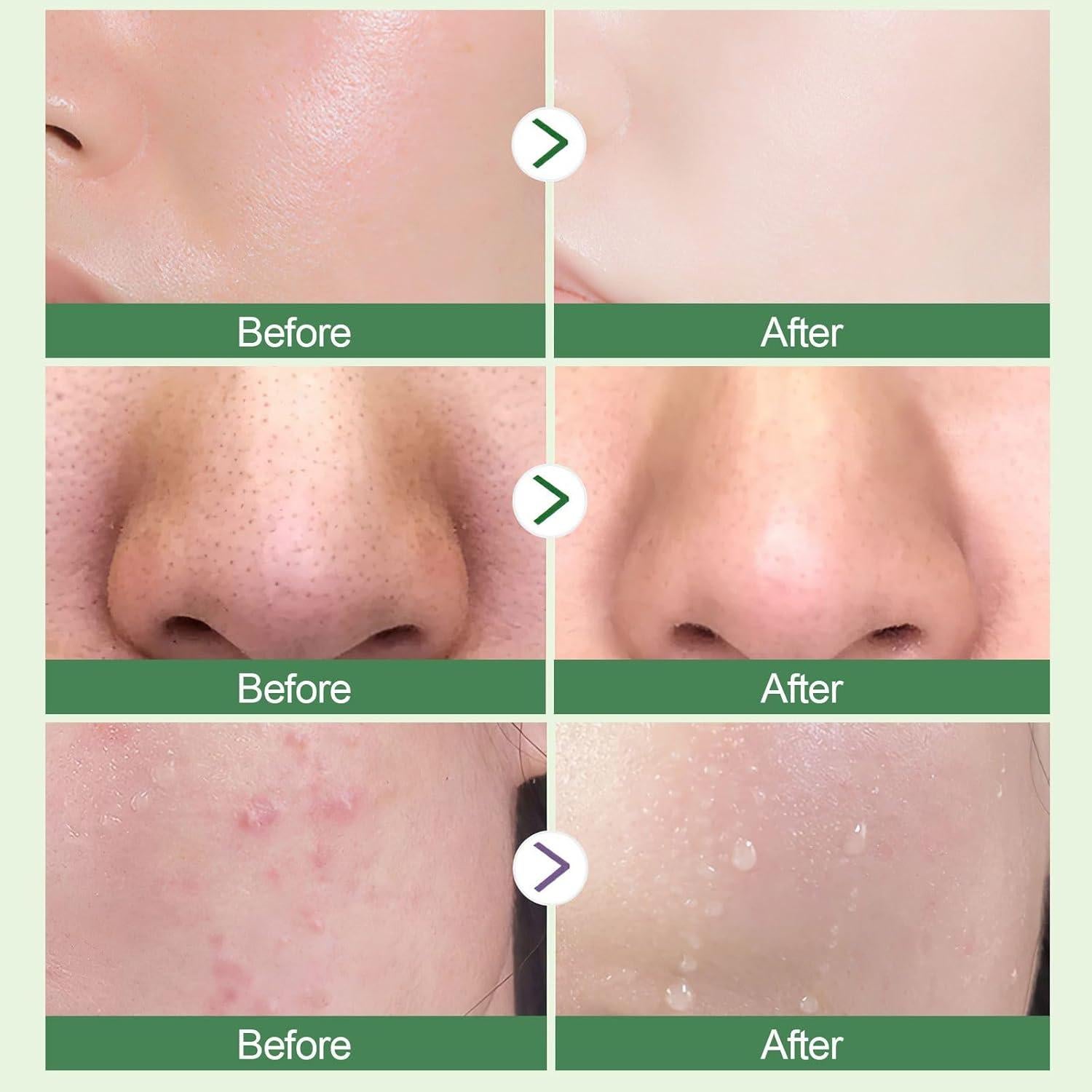 Mascarilla Facial de Barro Verde PAINISTIC - 2 Piezas