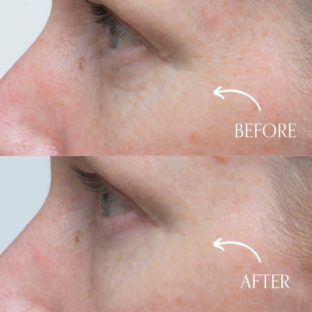 Suero de Infusión Juvenil Radical Skincare 29.57 ml - Hidrata y Suaviza