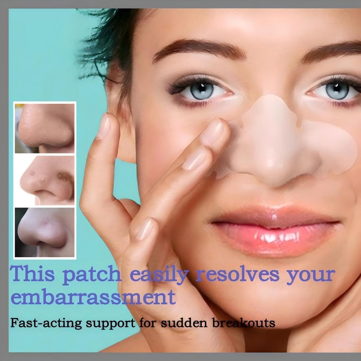 Parche de Acné Hidrocoloide Guiyal - 7 Piezas Grande