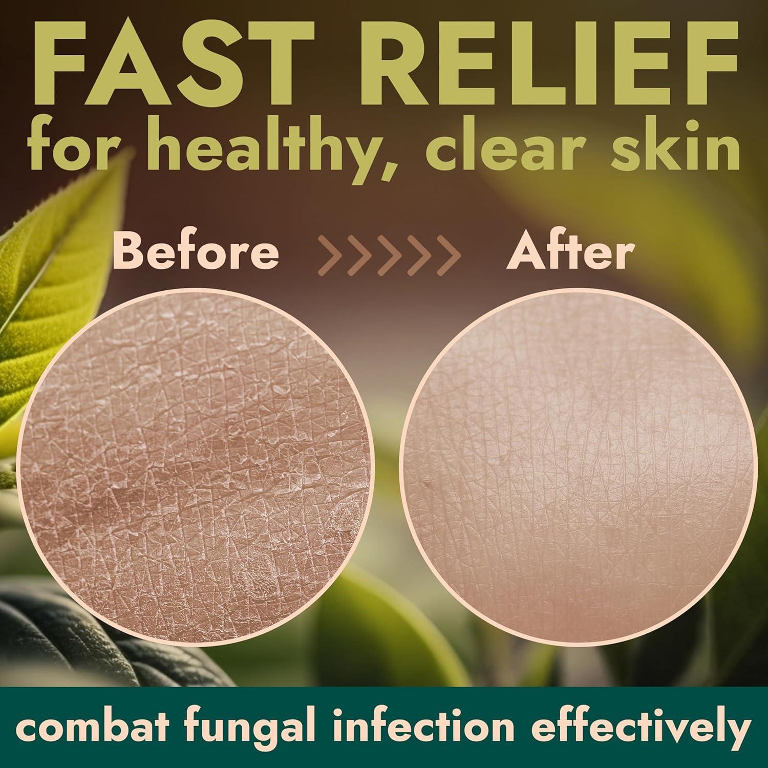 Jabón Corporal Antifúngico Terramed 500 ml - Antibacteriano