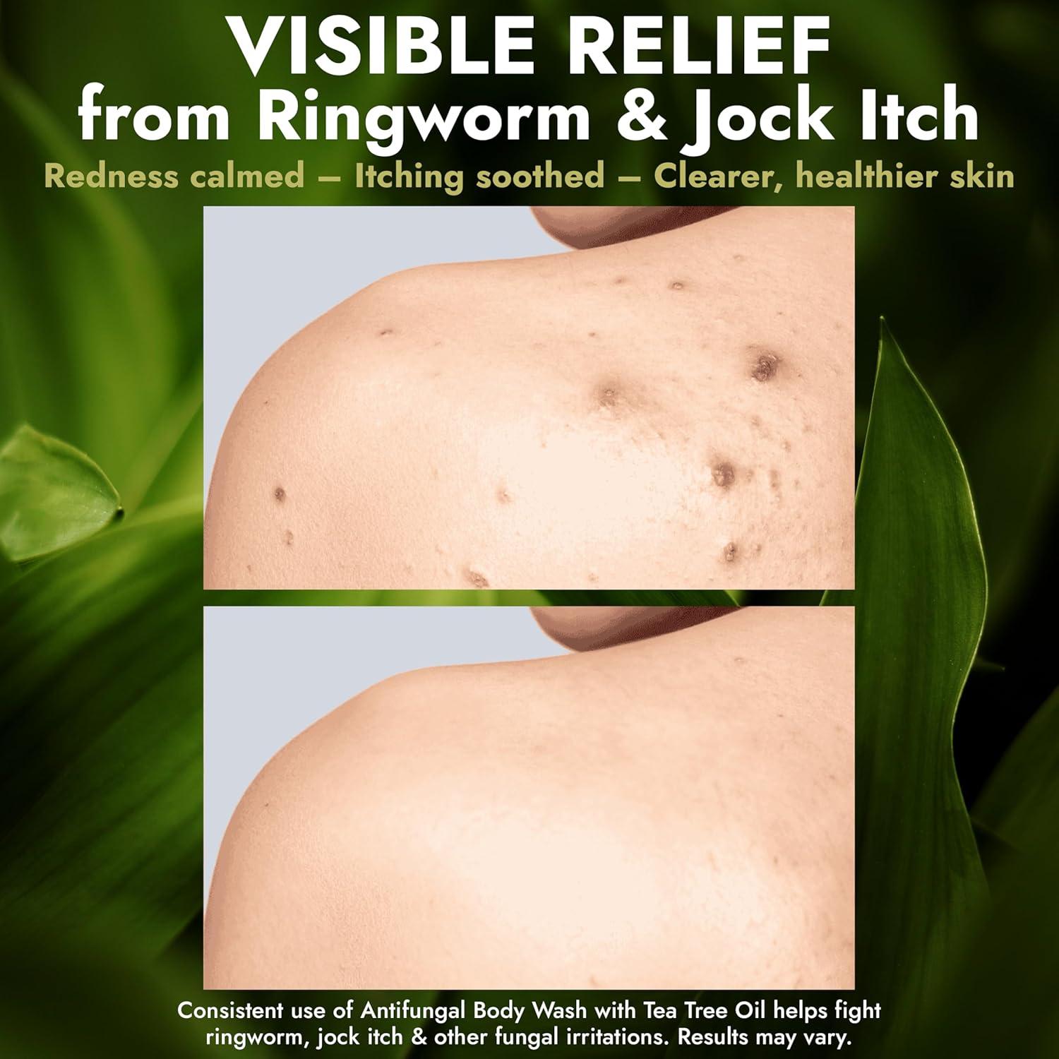 Jabón Corporal Antifúngico Terramed 500 ml - Antibacteriano