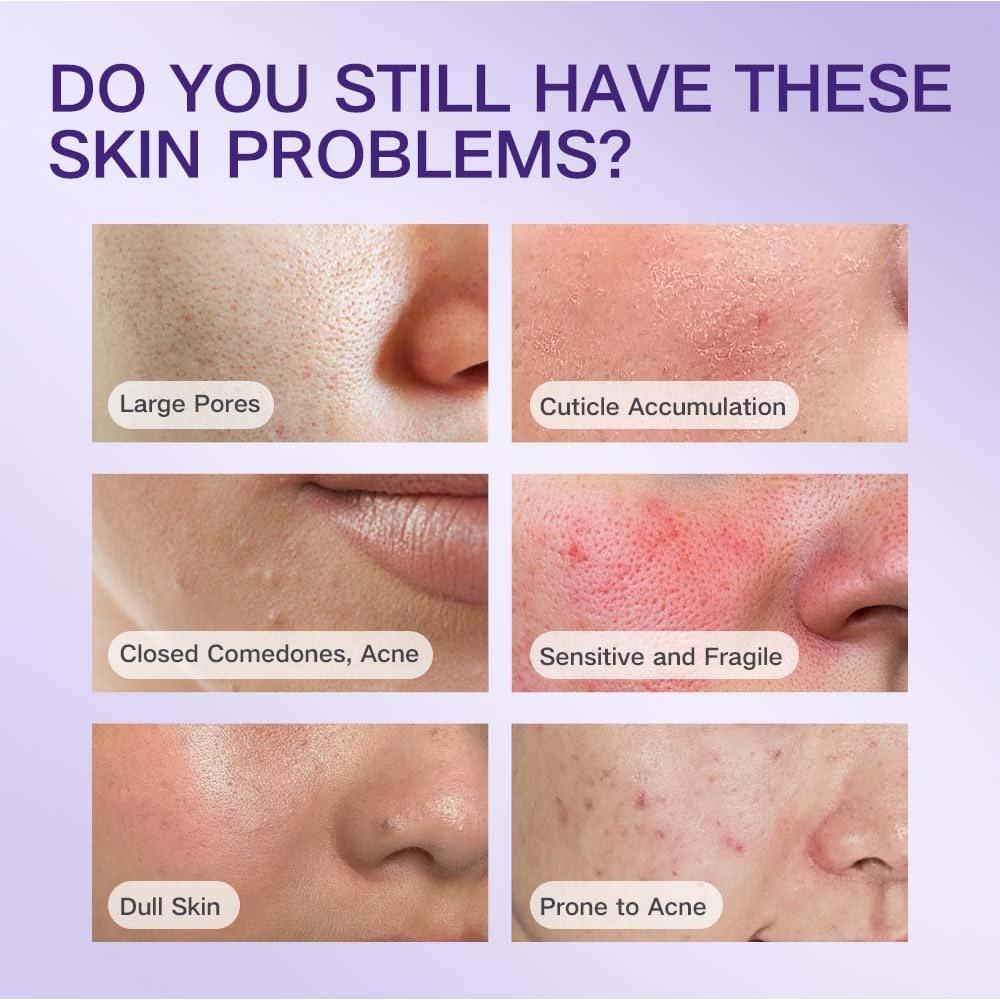 Limpiador Facial Exfoliante Hotluck 80g - Hidratante y Suave