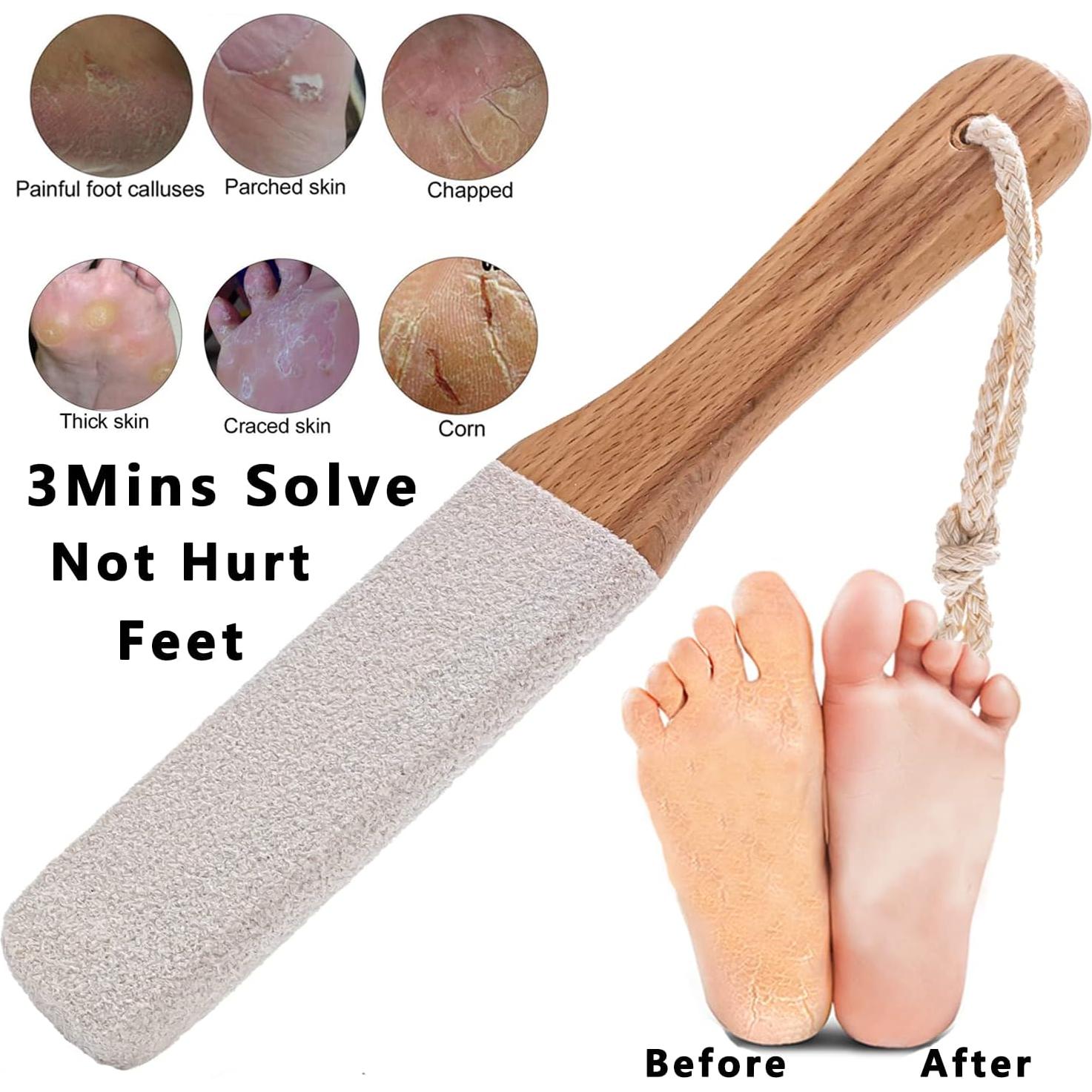 Removedor de Callos Kinepi Lima de Pies de Madera y Corindón