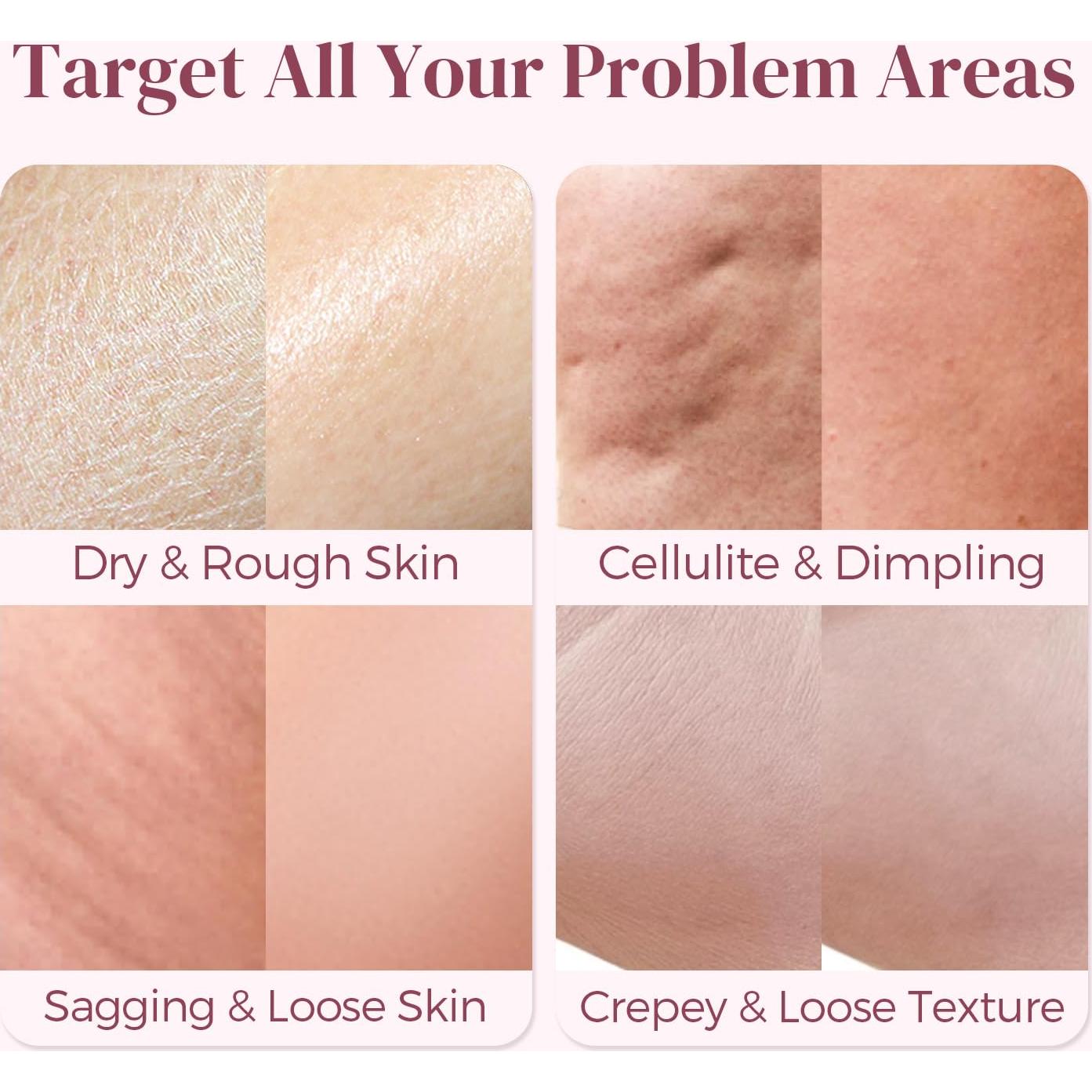 Crema Anticelulitis LIFTONIN 109.8 ml - Reafirmante y Tonificante