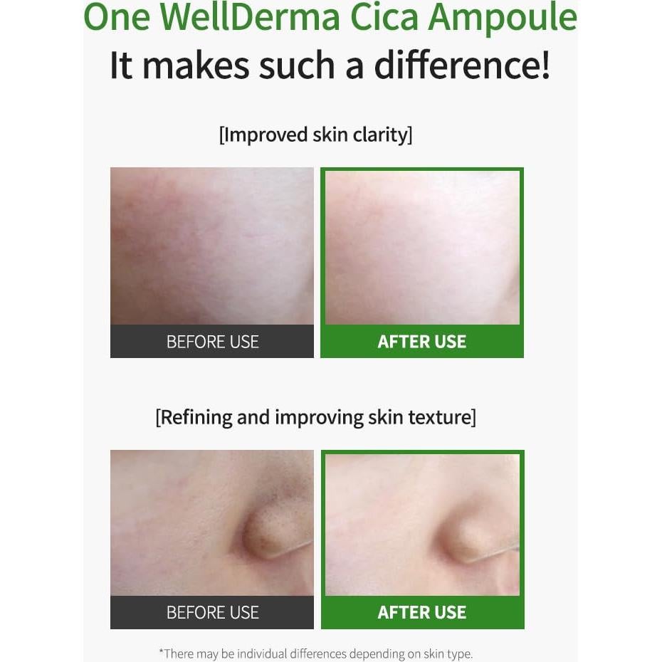 Sérum Hidratante Cica Herb Tox WELLDERMA 50mL - Centella Asiática