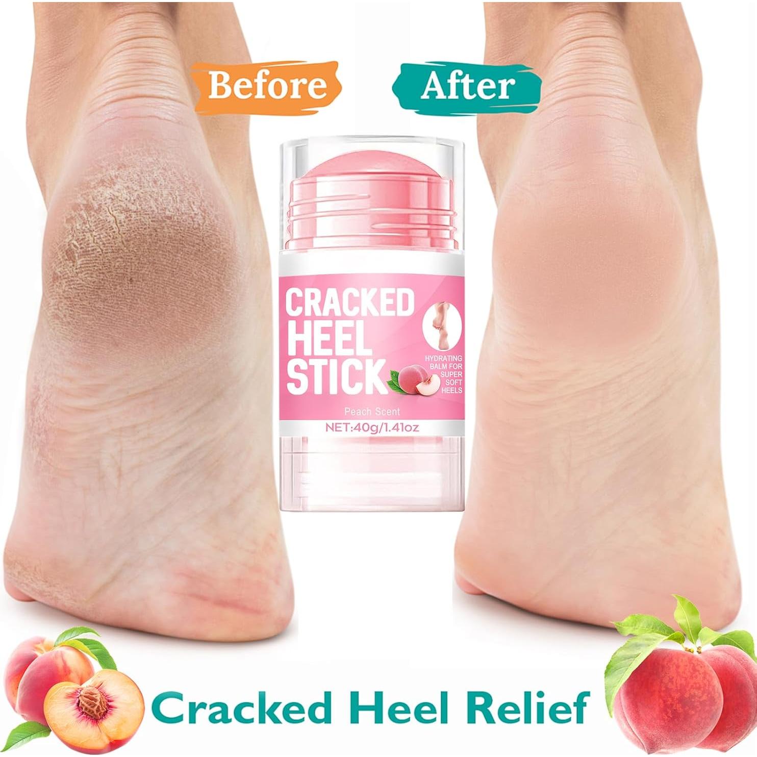 Crema para pies hidratante Lingyun 60% urea 2% ácido salicílico