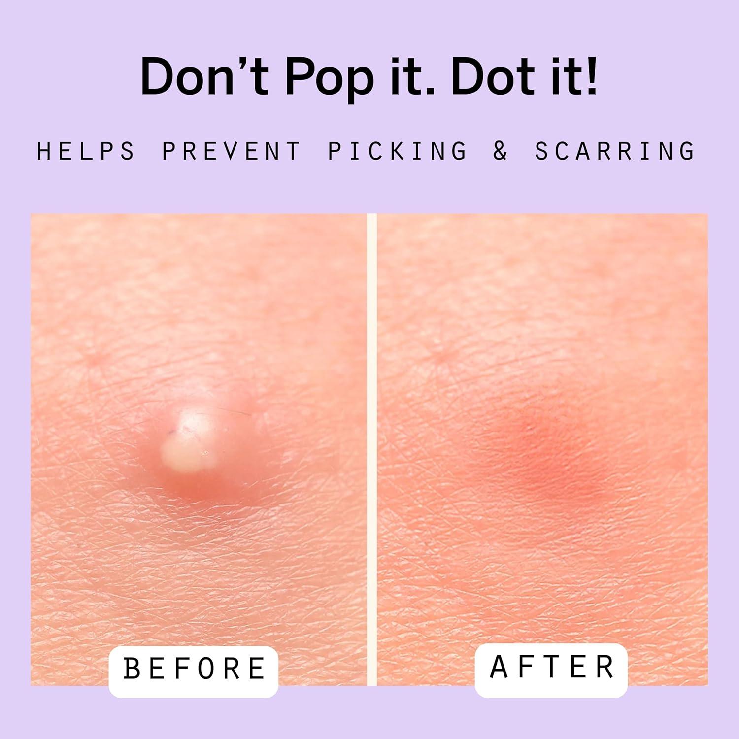 Parche Hidrocoloide para Granos Dot - 40 Unidades 10 mm