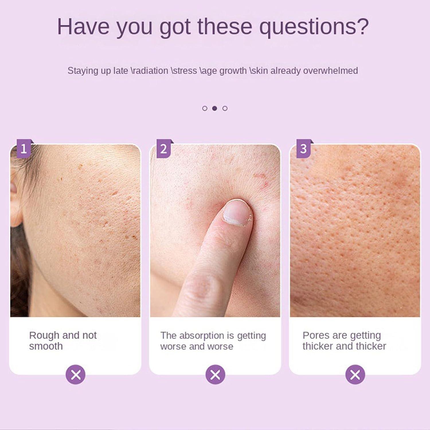 Rodillo de Hielo Facial KERYALELA 2 en 1 para Mujeres