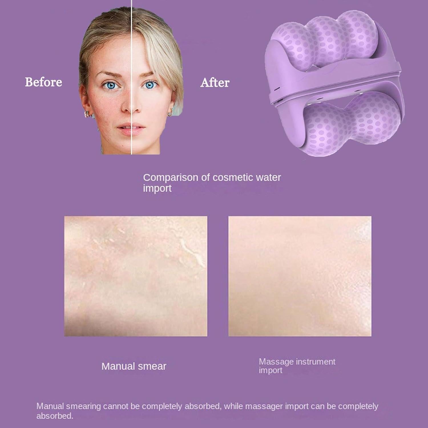 Rodillo de Hielo Facial KERYALELA 2 en 1 para Mujeres