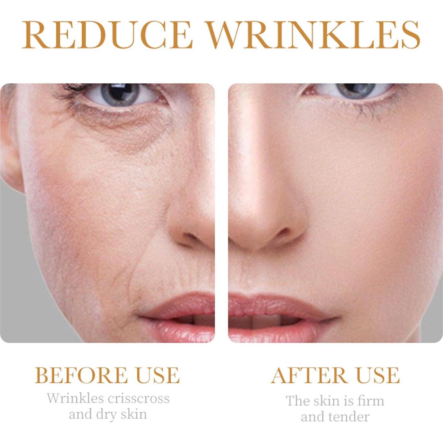 Juego de Cuidado Facial Antienvejecimiento Rosarden 6 Piezas