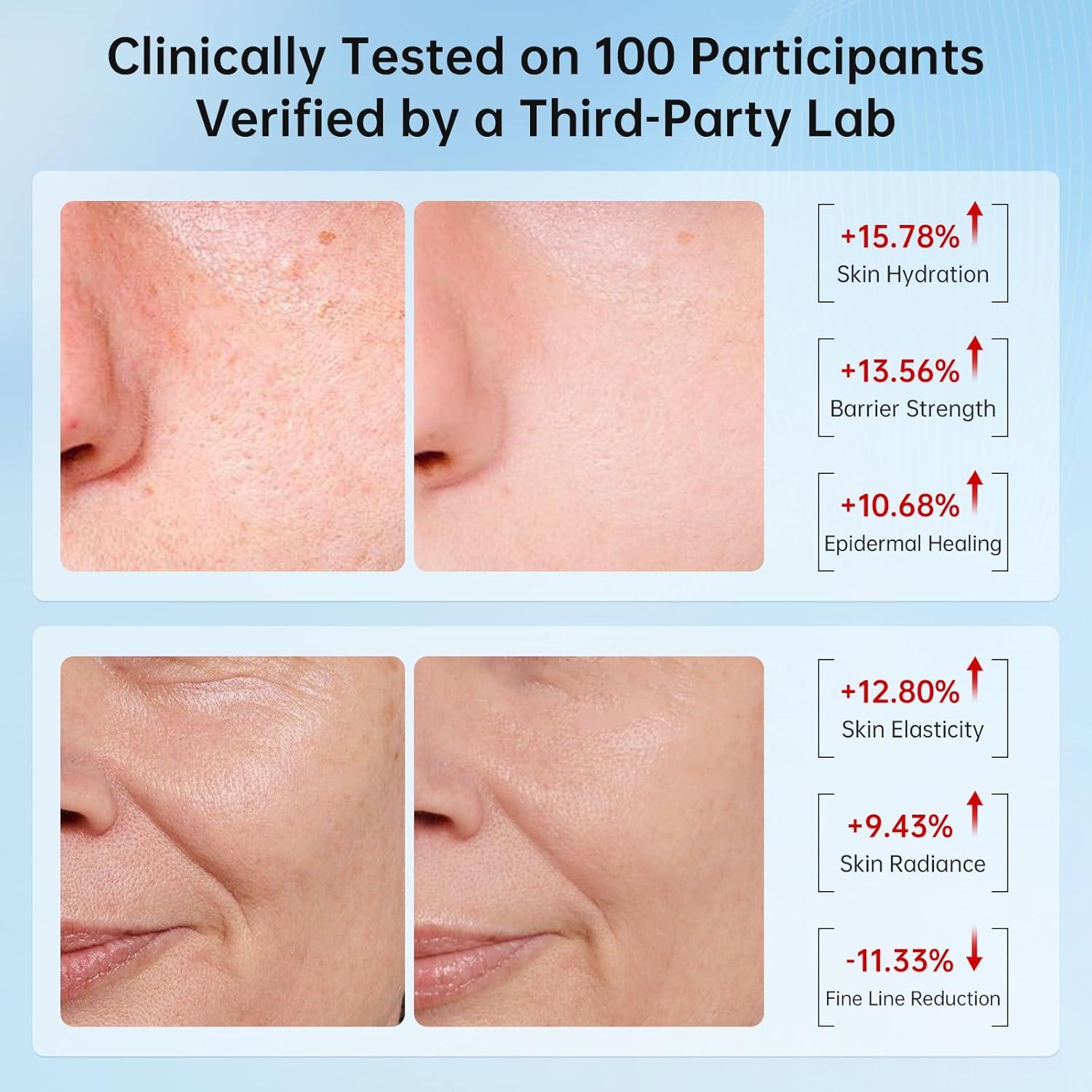 VGO Mucina de Caracol 92% Hidratante Facial 50g Piel Seca/Sensible