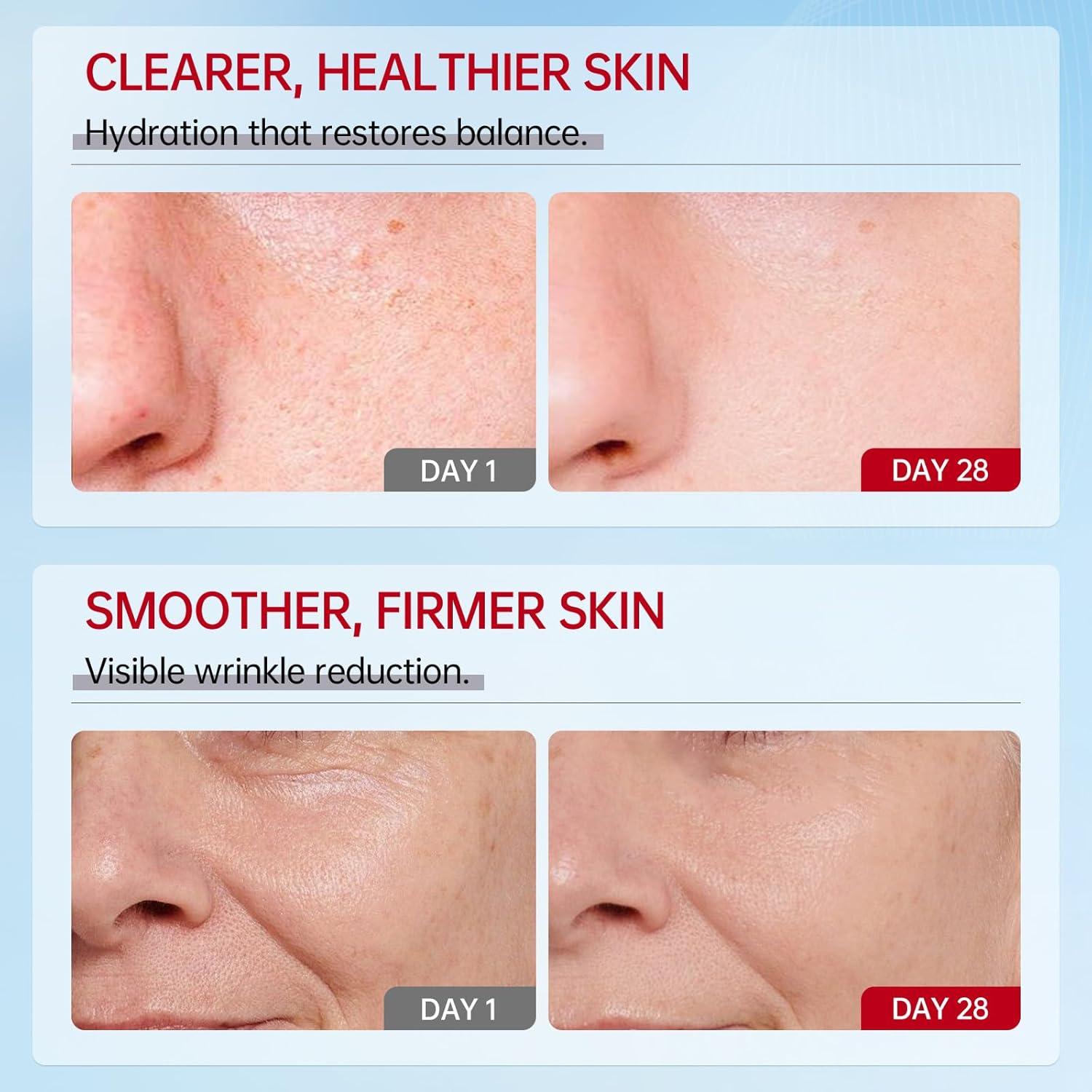 VGO Mucina de Caracol 92% Hidratante Facial 50g Piel Seca/Sensible