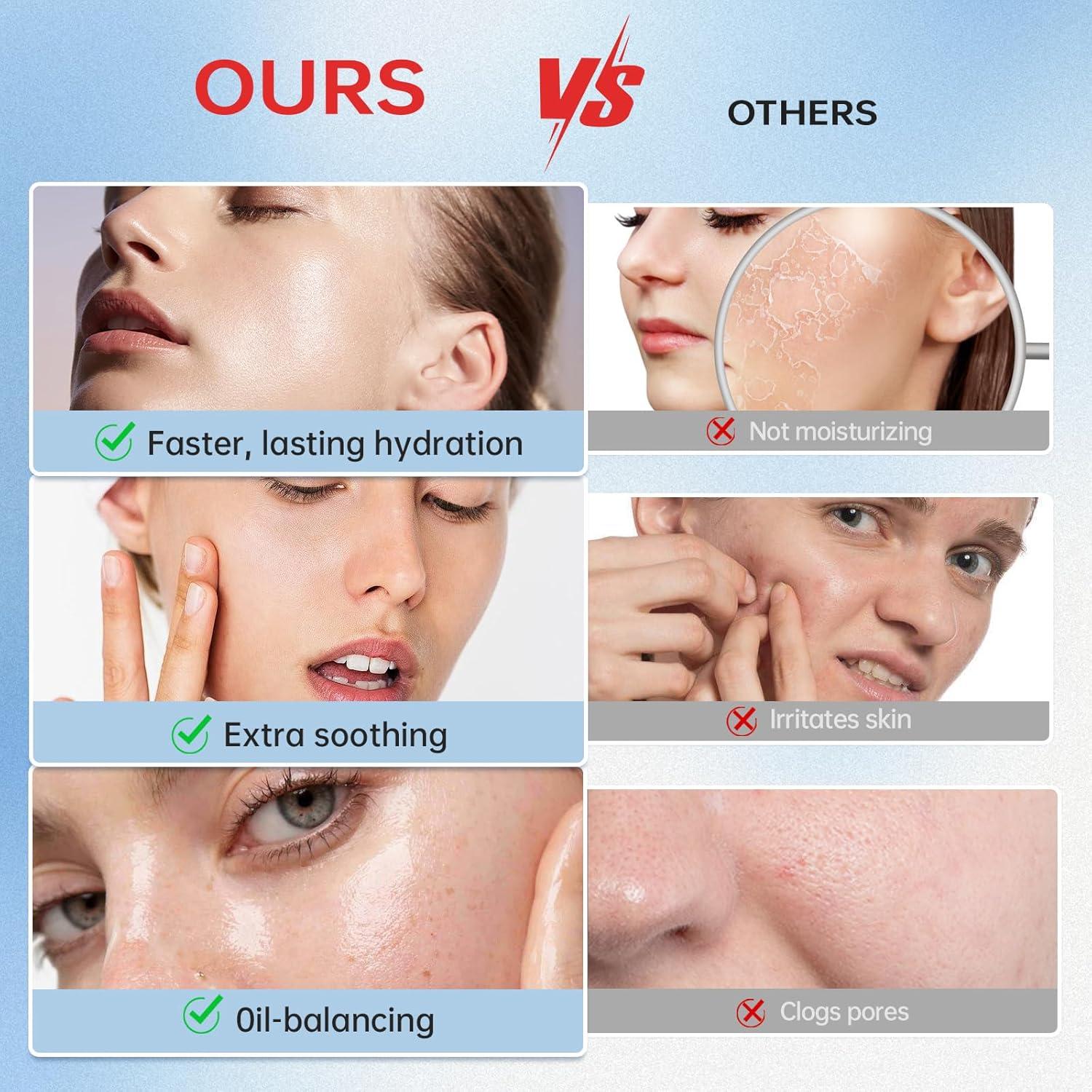 VGO Mucina de Caracol 92% Hidratante Facial 50g Piel Seca/Sensible