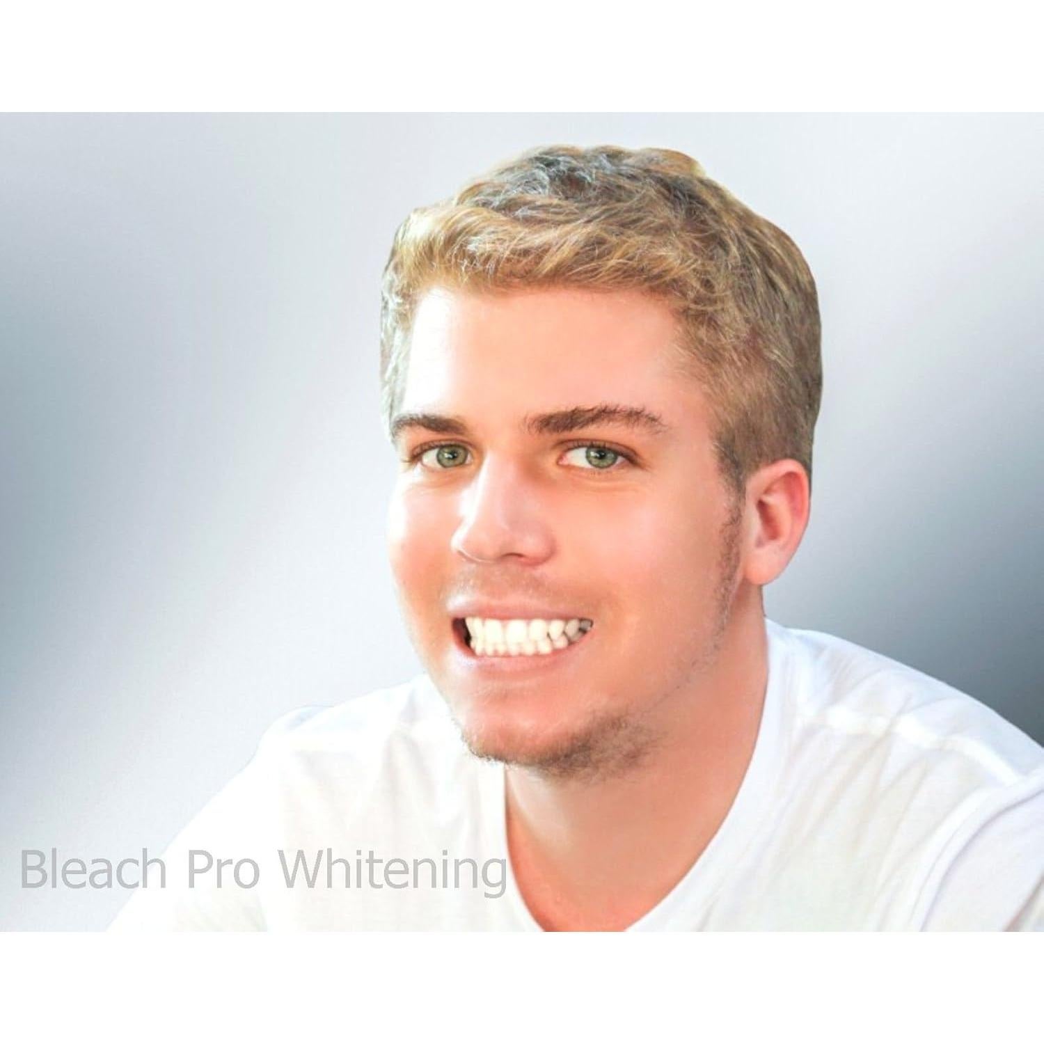 Gel Blanqueador Dental 22% Bleach Pro - 10 Jeringas de 3ml