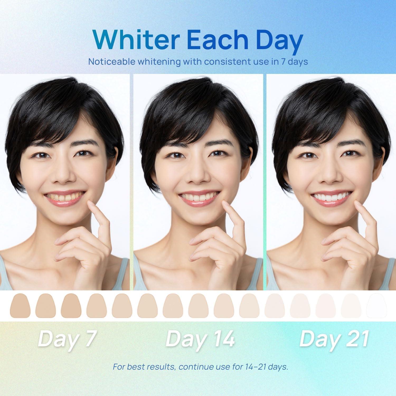 Tiras Blanqueadoras Whitebite Pro - 14 Tratamientos Naturales