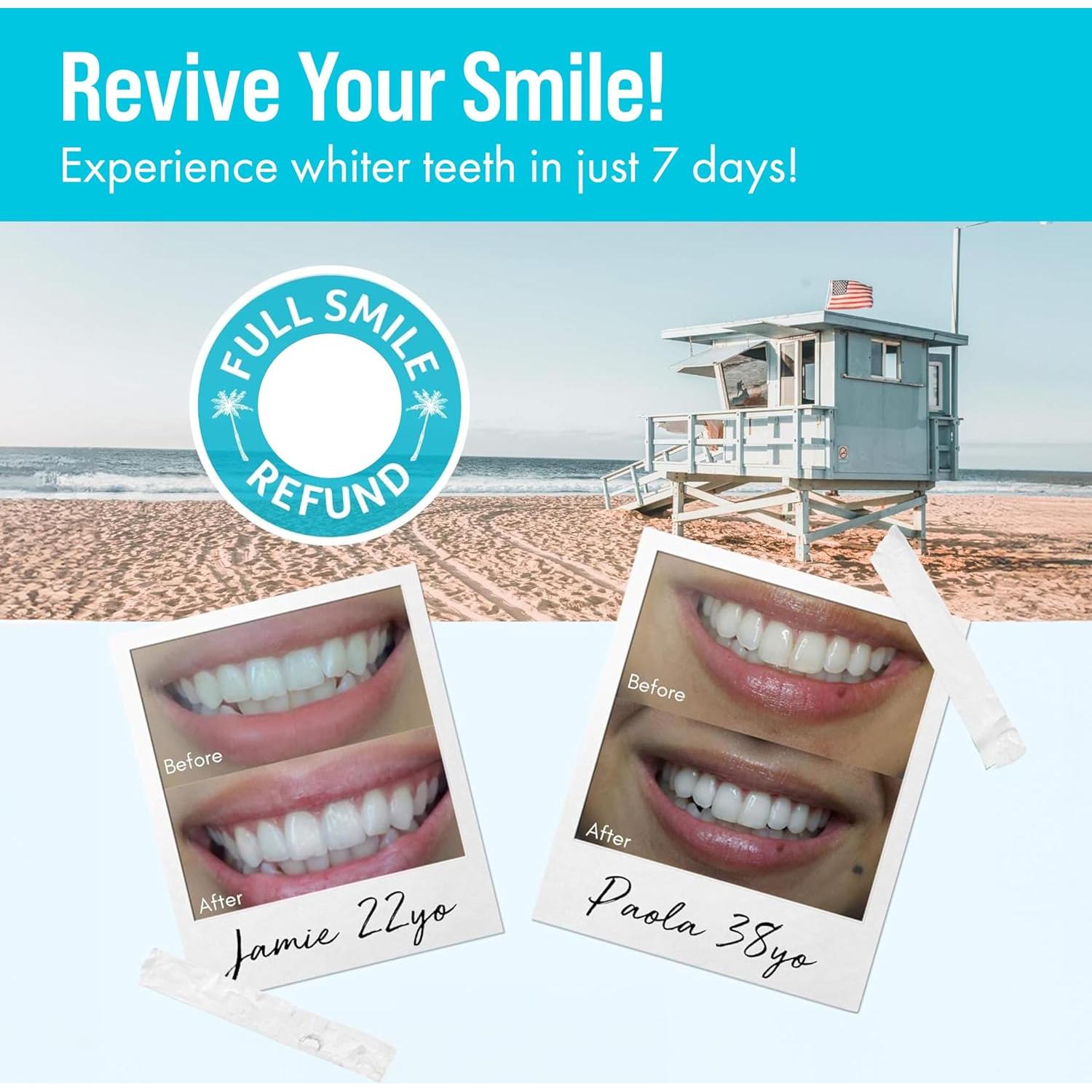 Recargas Gel Blanqueador Dental Cali White 3 x 5 ml 35% Peróxido