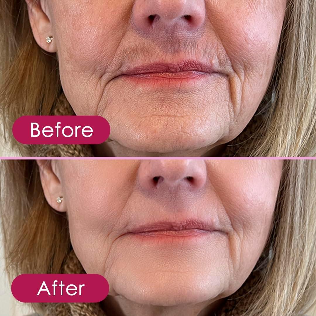 Epilador de Vello Facial Glabrous Skin - Suavidad Duradera