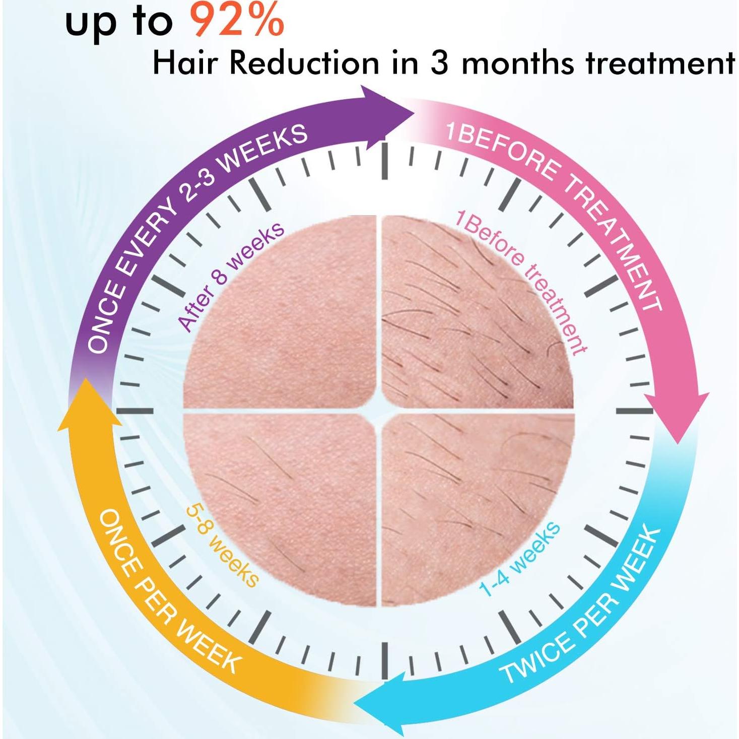 Máquina de Depilación IPL IMENE T1 500,000 Destellos Frío