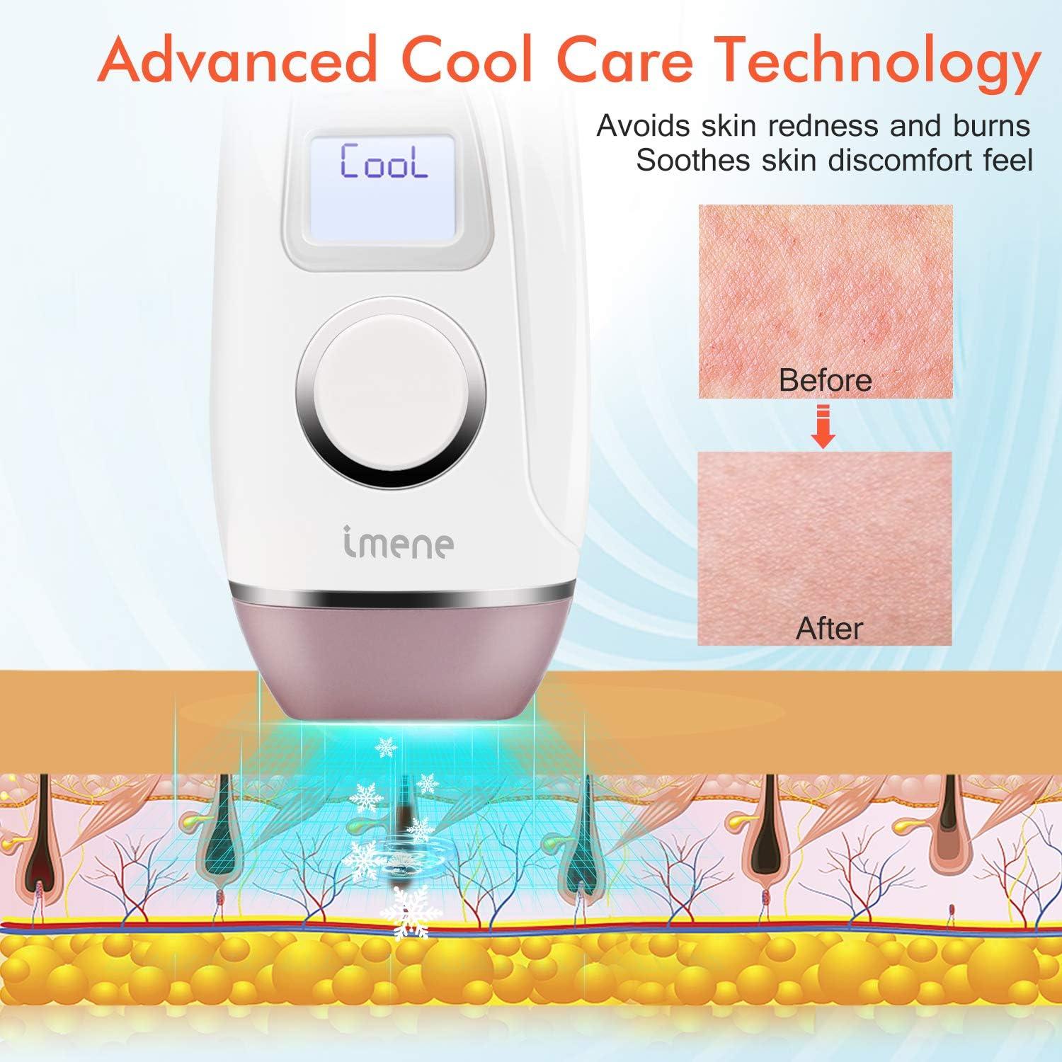 Máquina de Depilación IPL IMENE T1 500,000 Destellos Frío