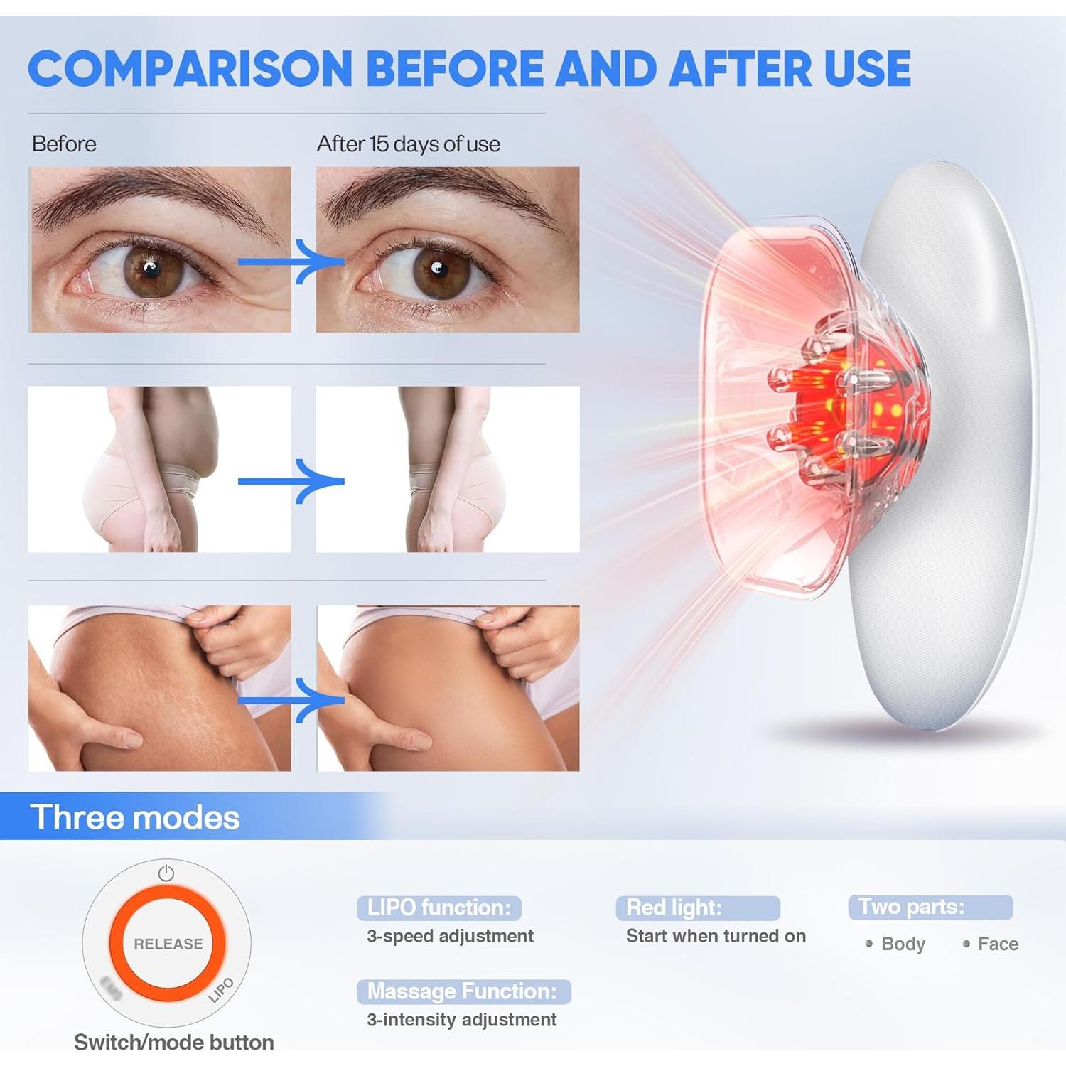 Masajeador Eléctrico de Celulitis 3-en-1 Ciyada - Blanco