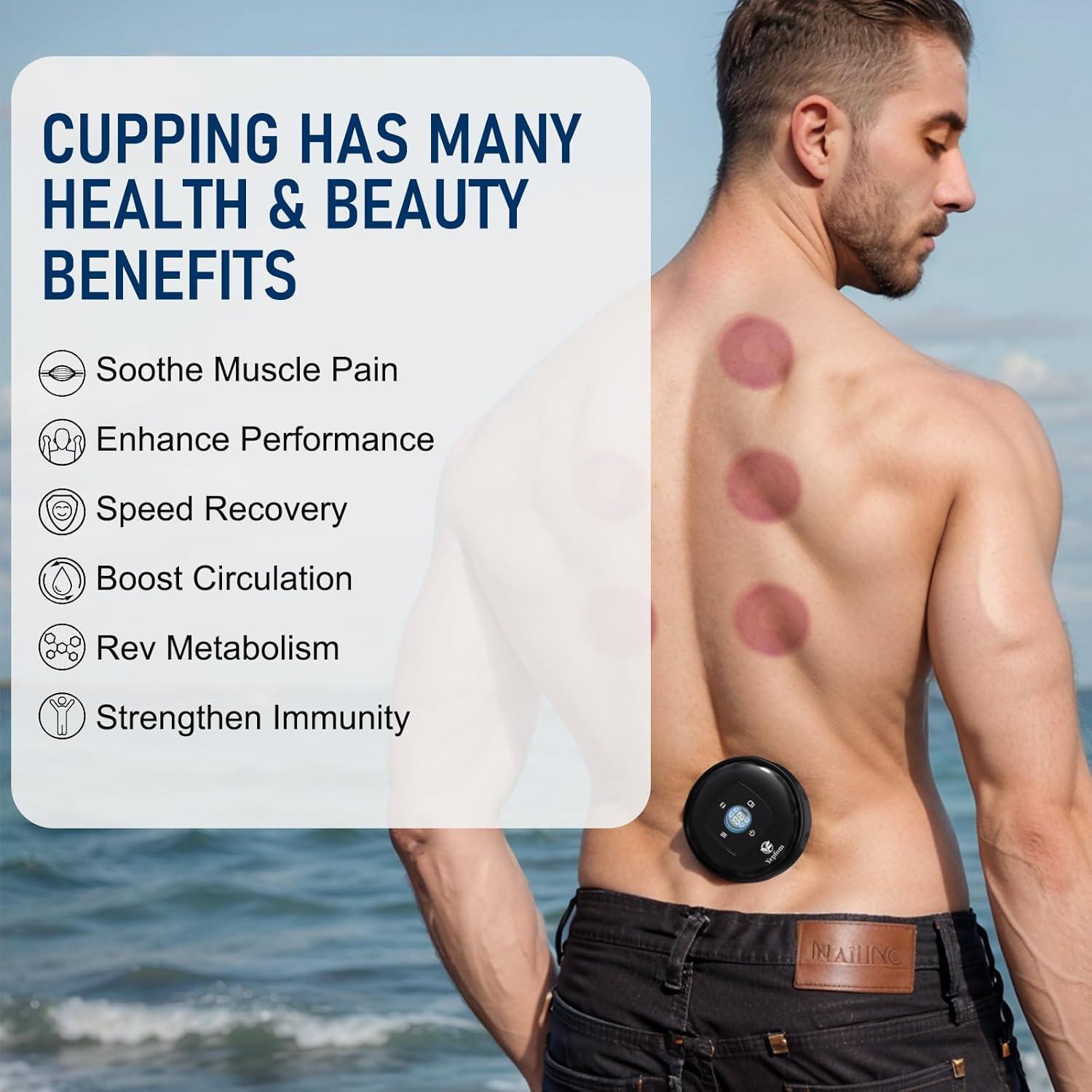 Set de Ventosas Inteligente 5-en-1 Yepfom con Calor y Luz Roja