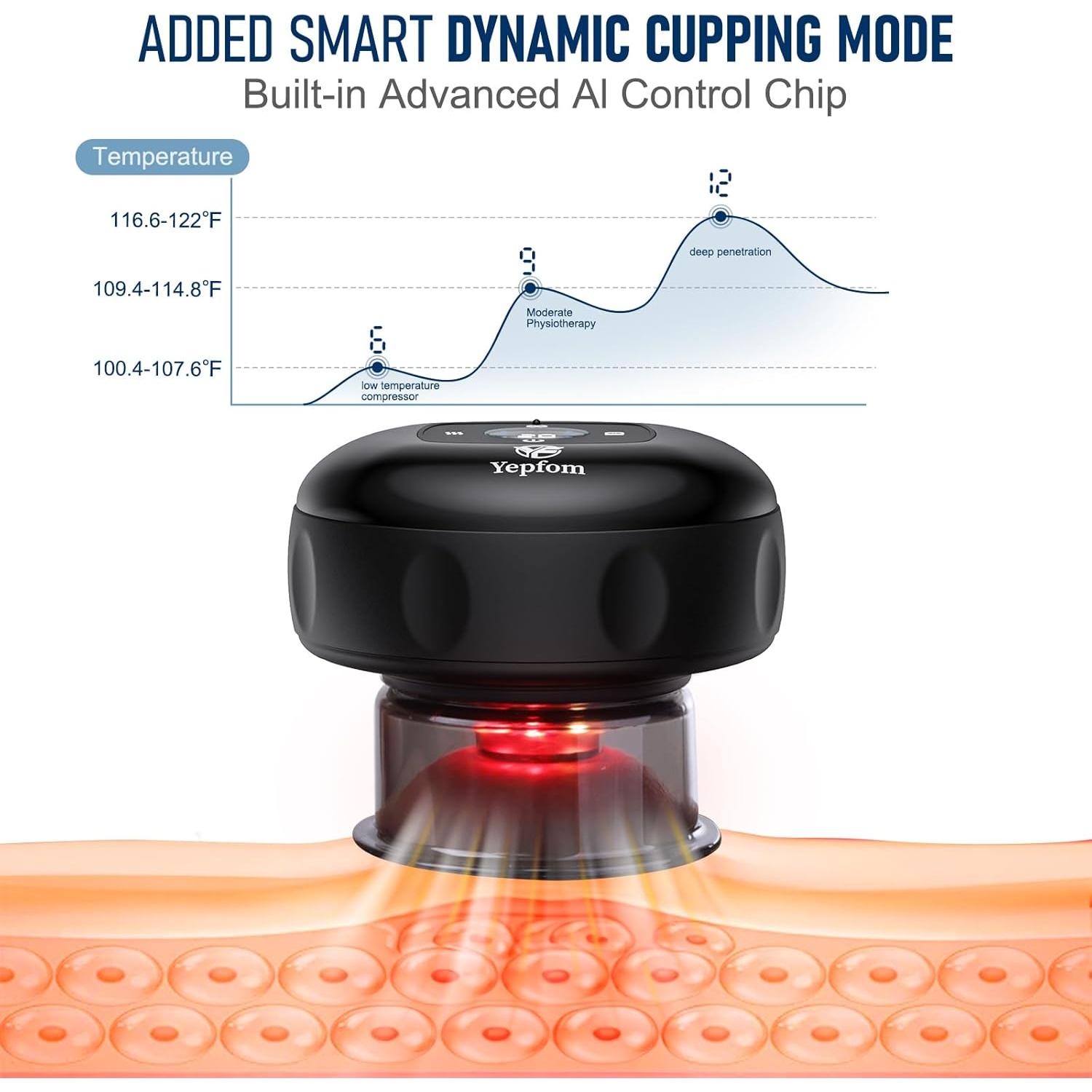 Set de Ventosas Inteligente 5-en-1 Yepfom con Calor y Luz Roja