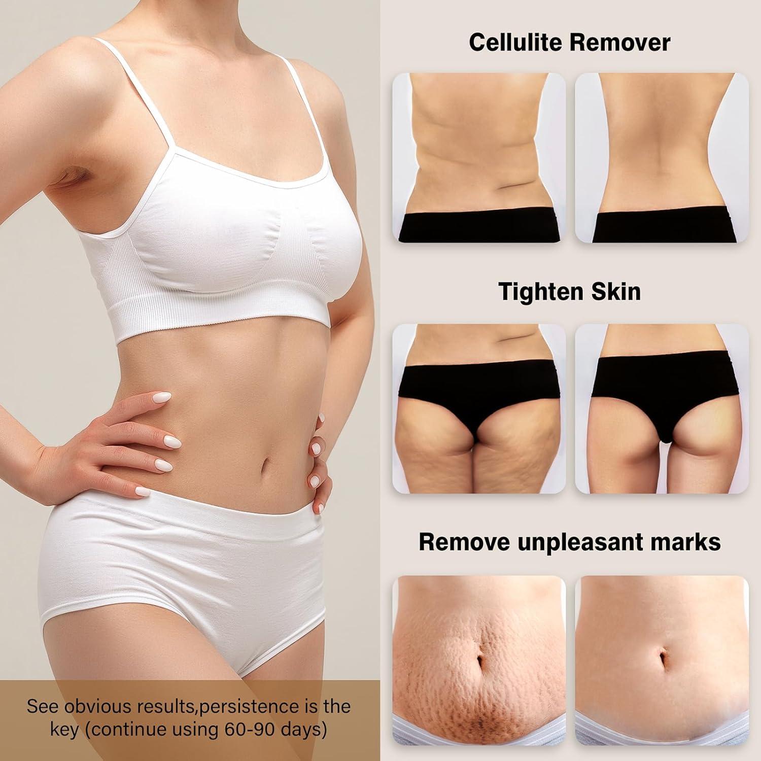 Masajeador Corporal Portátil MOYAC M802 Blanco - Sin Cable