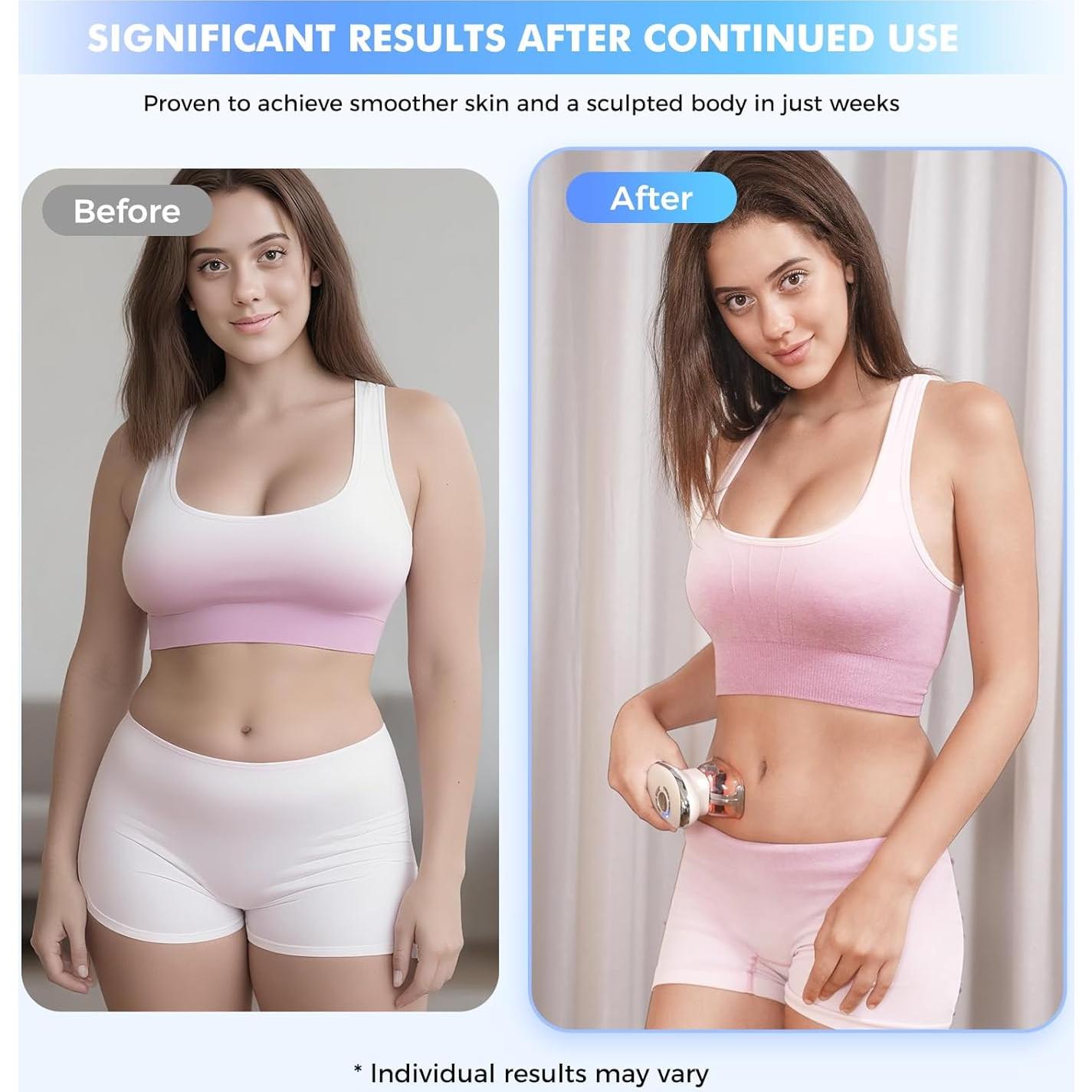 REDLOOK Escultor Corporal 3-en-1 - Masajeador Anticelulitis