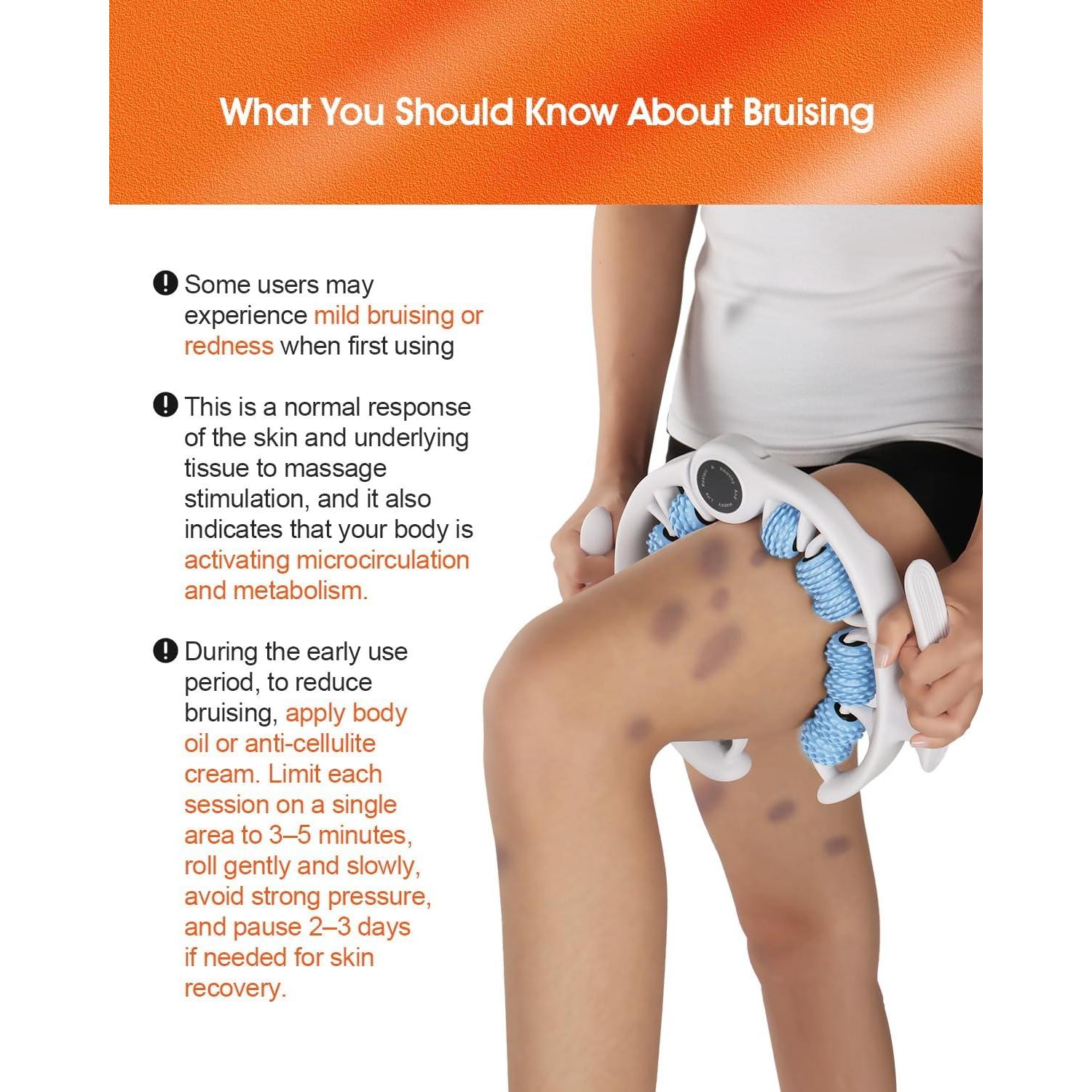 Rodillo de Masaje Anticelulitis Rovista Azul - Drenaje Linfático