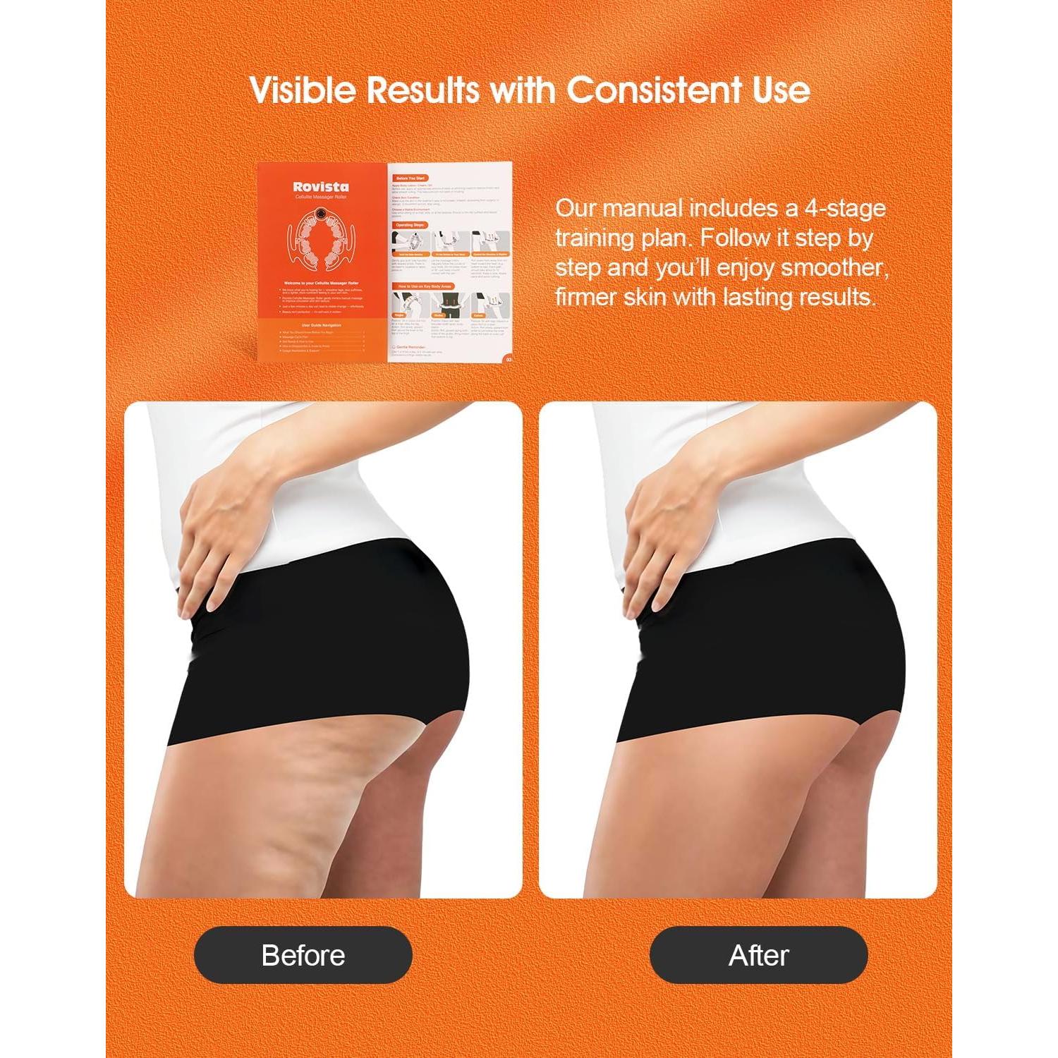 Rodillo de Masaje Anticelulitis Rovista Azul - Drenaje Linfático