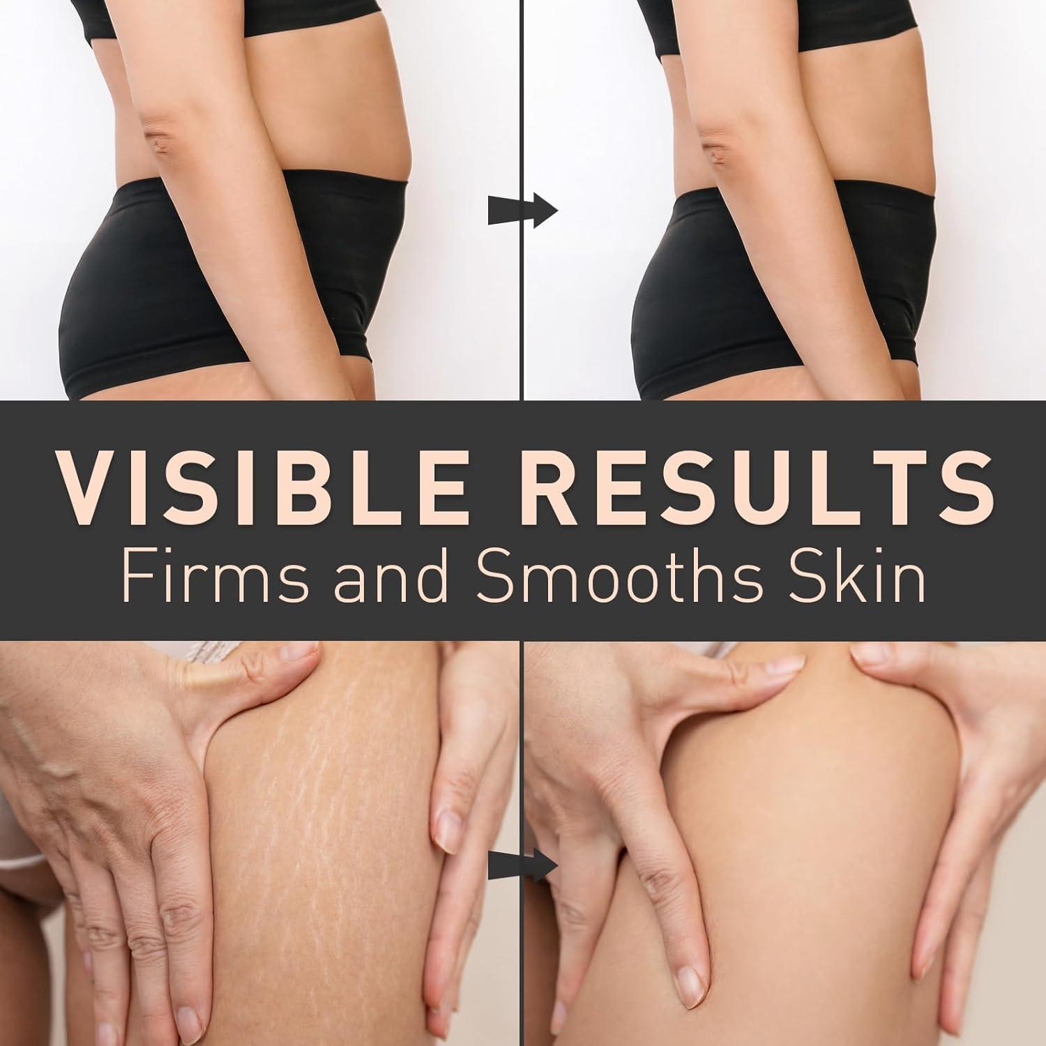 Crema Reafirmante para Abdomen Enaskin Naturals 100 ml