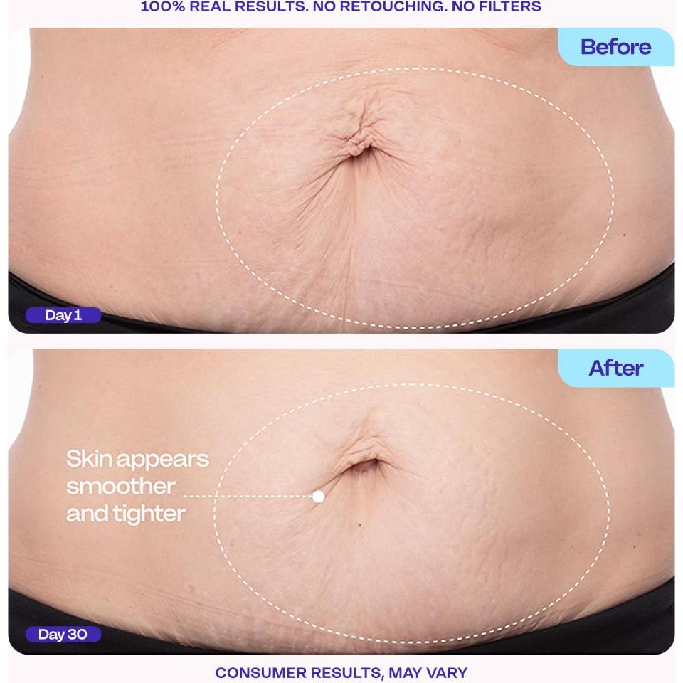 Crema Reafirmante goPure para Abdomen 120g - Reduce Estrías