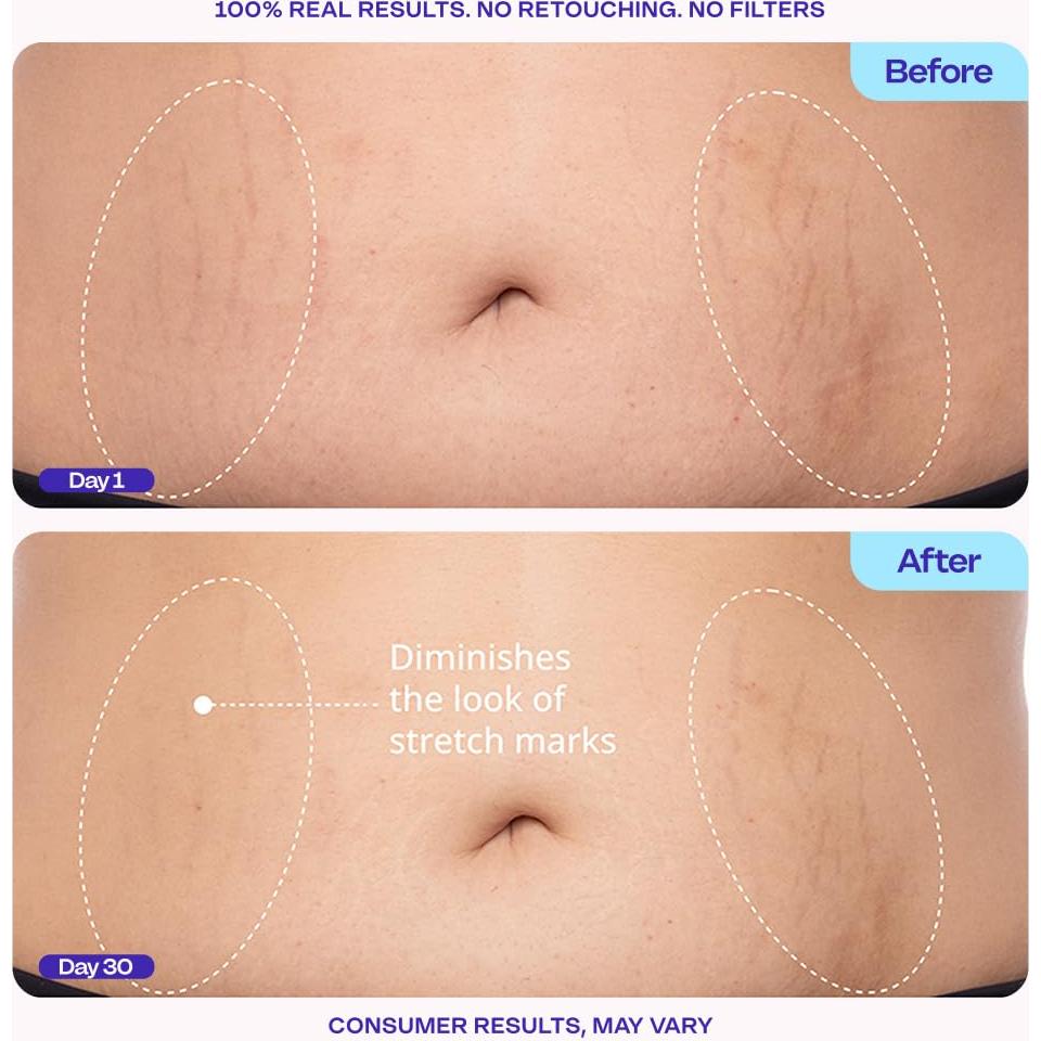 Crema Reafirmante goPure para Abdomen 120g - Reduce Estrías
