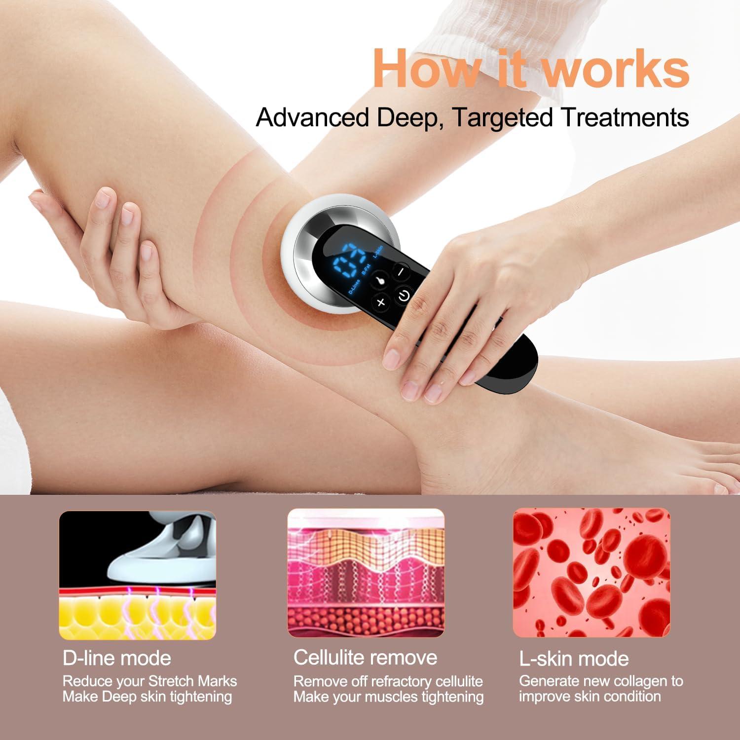 Masajeador de Celulitis CENXIGO Profesional 340g 3 Modos