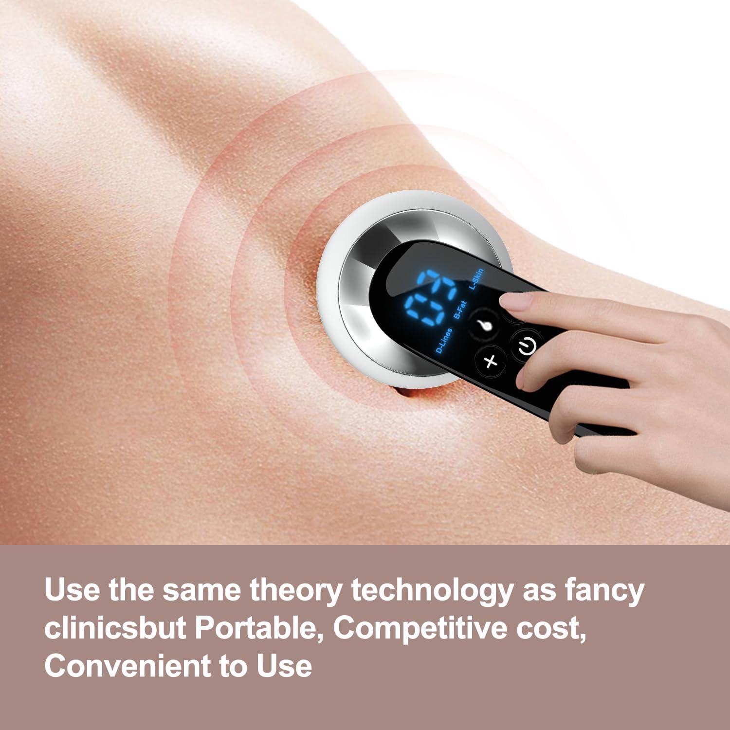 Masajeador de Celulitis CENXIGO Profesional 340g 3 Modos