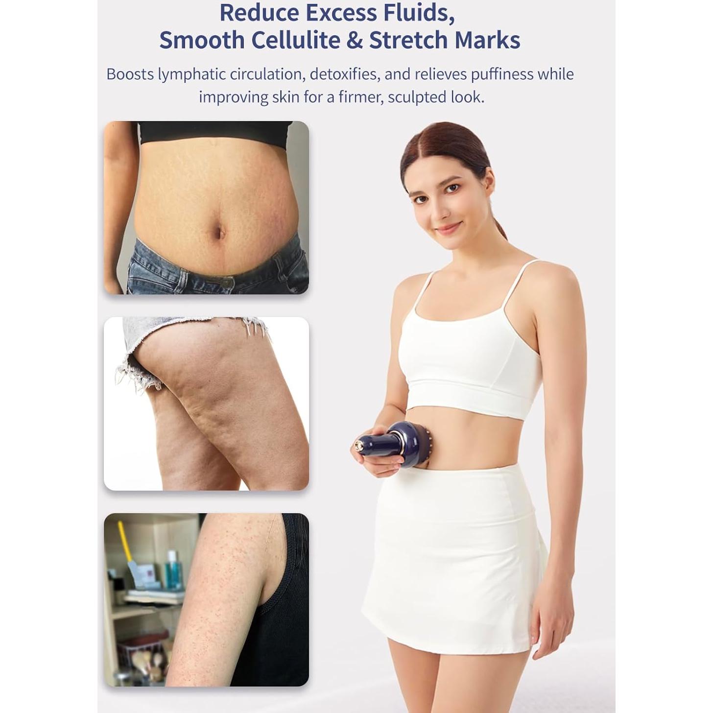 Masajeador Drenaje Linfático Paiaito G05, Anticelulitis, Calor y Vibración