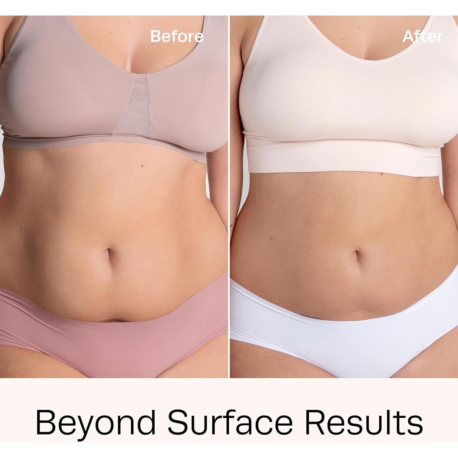 Gel Corporal Hot Vita Slimdown 170g - Anticelulitis y Reafirmante