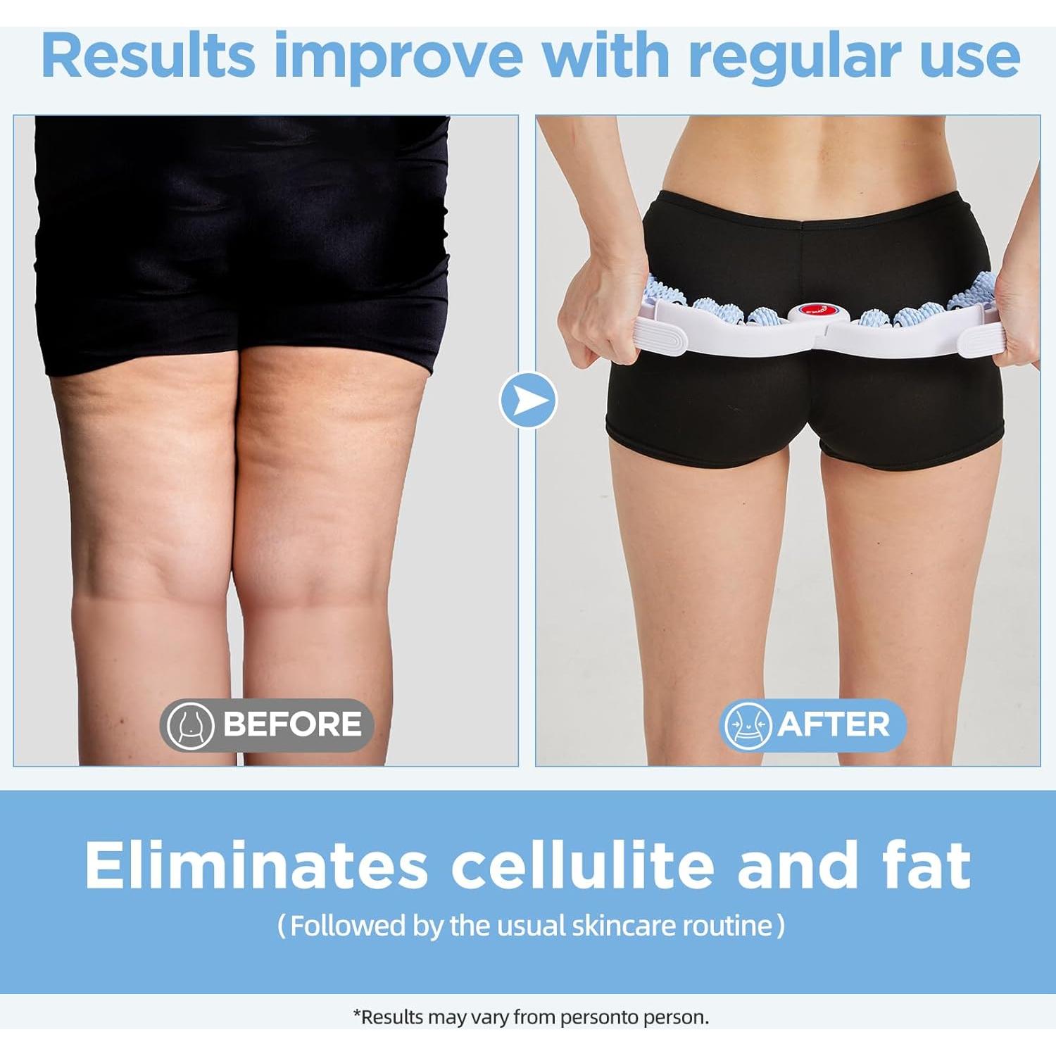 Rodillo de Masaje Anticelulitis MZDXJ - 8 Ruedas, Alivio Dolor