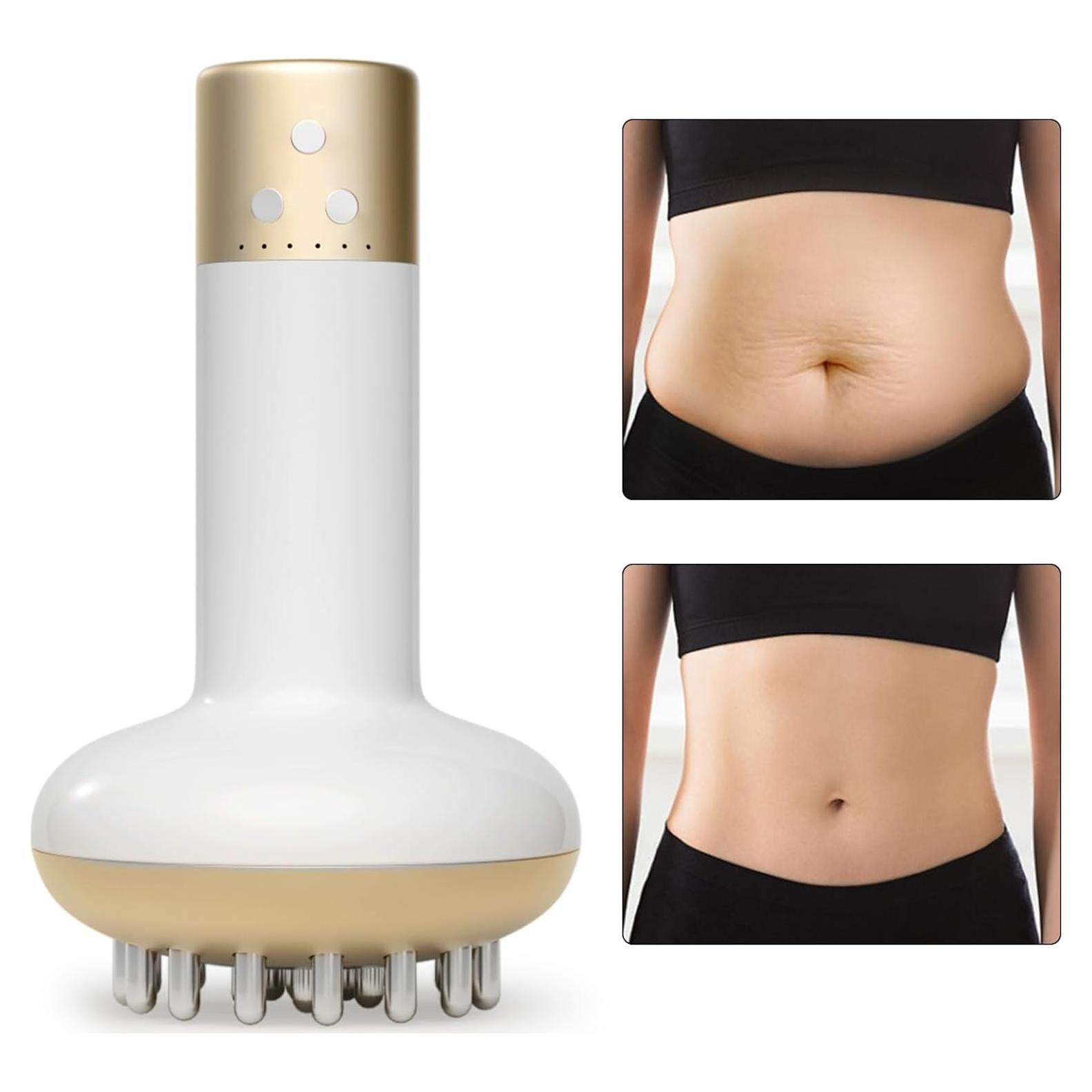 Masajeador Drenaje Linfático Anticelulitis 4-en-1 Portátil