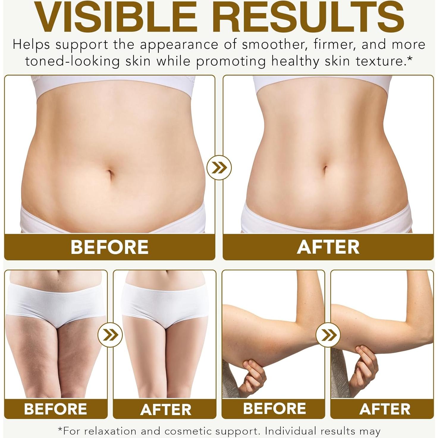 Masajeador Drenaje Linfático Anticelulitis 4-en-1 Portátil