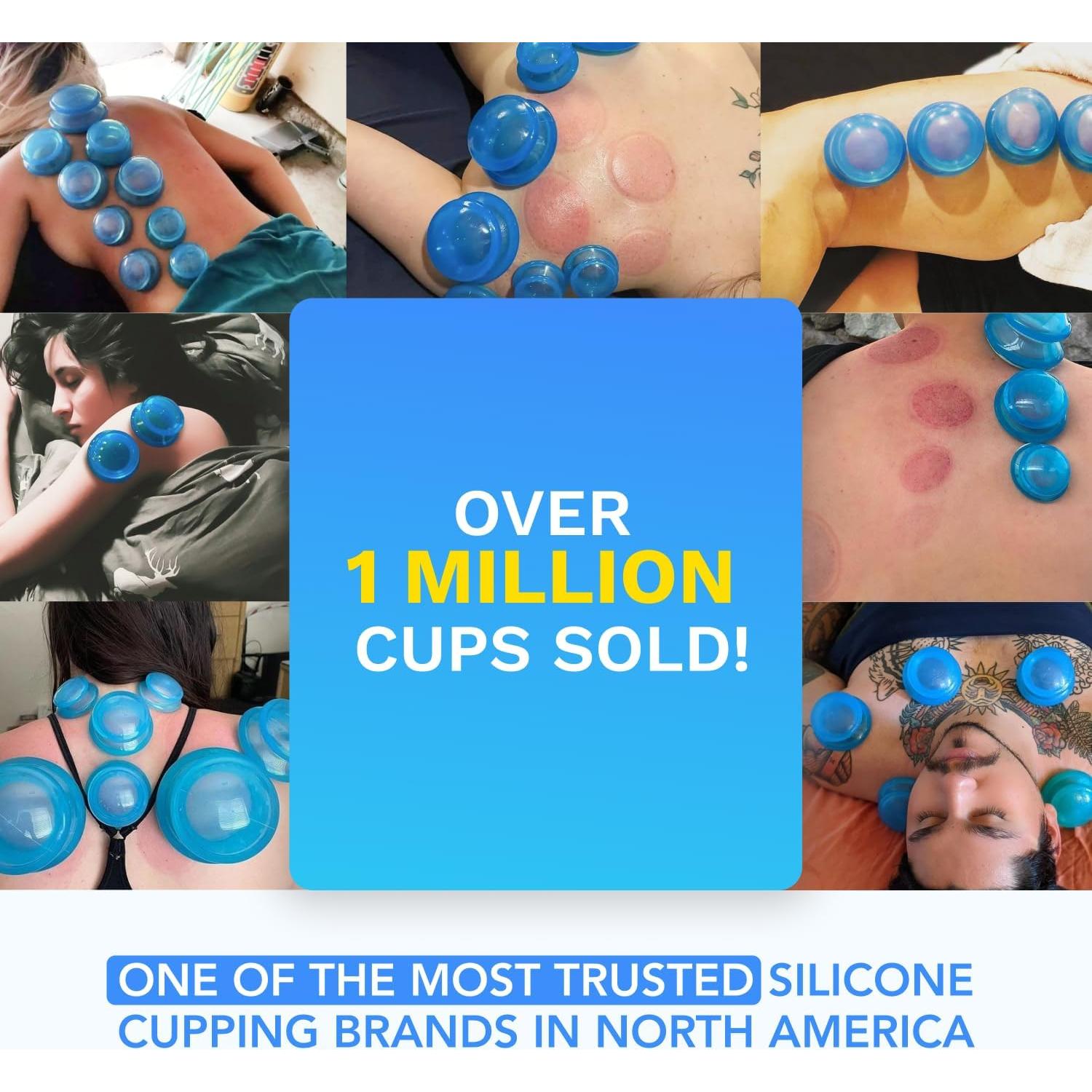 Juego de Ventosas de Silicona Lure Essentials - 4 Copas para Masaje