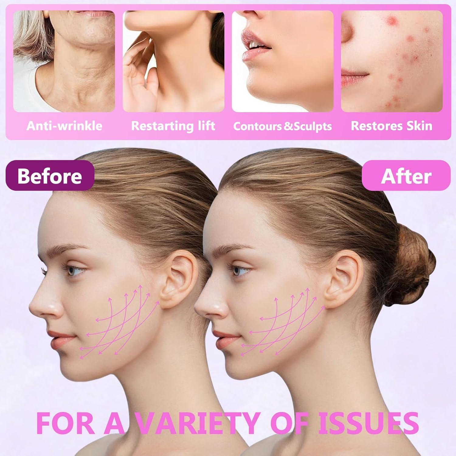 Correa Facial Reutilizable FGNL para Doble Mentón - Grafeno