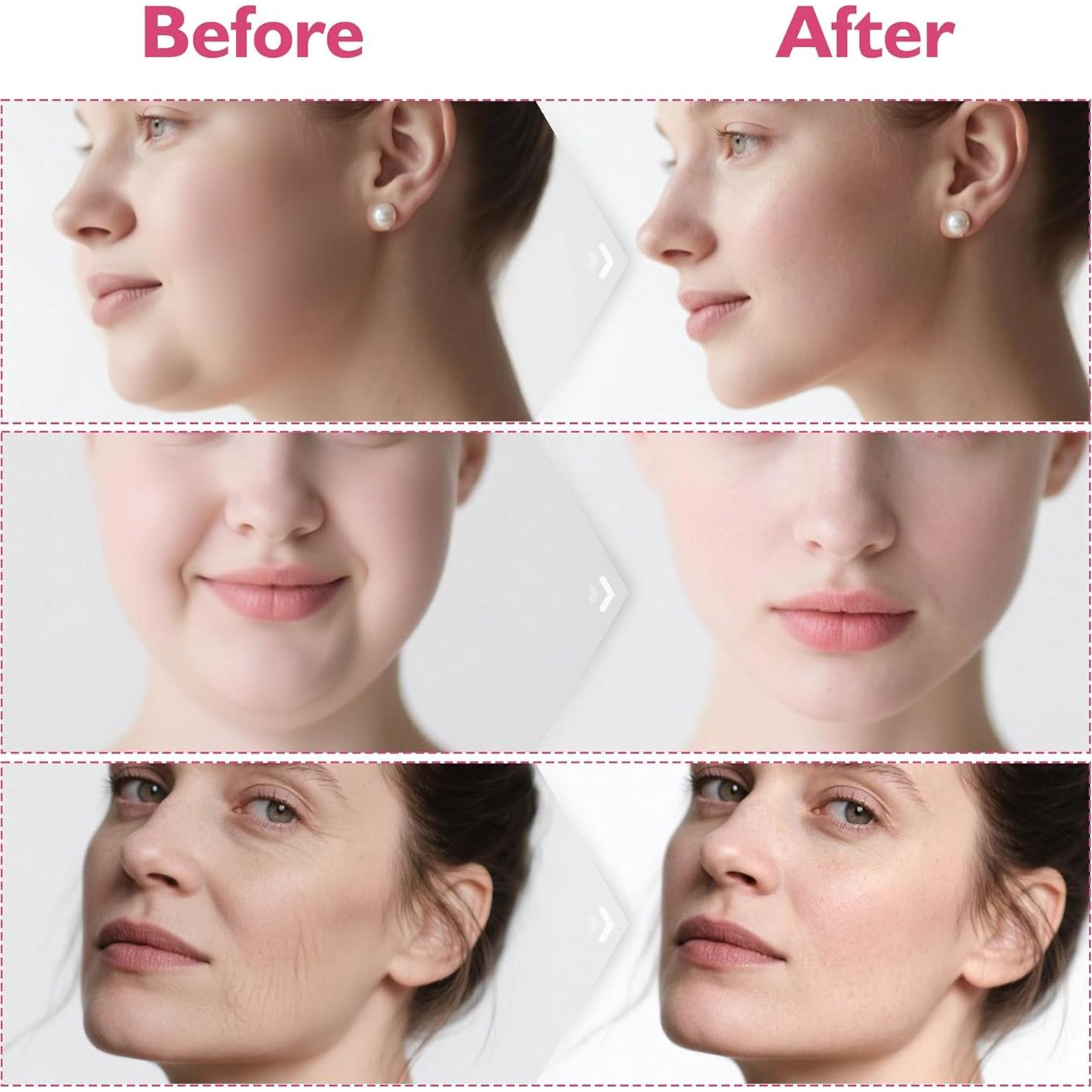 Conjunto Reductor Doble Papada Azrra - Máscara Elevadora V y Ejercitador Mandíbula