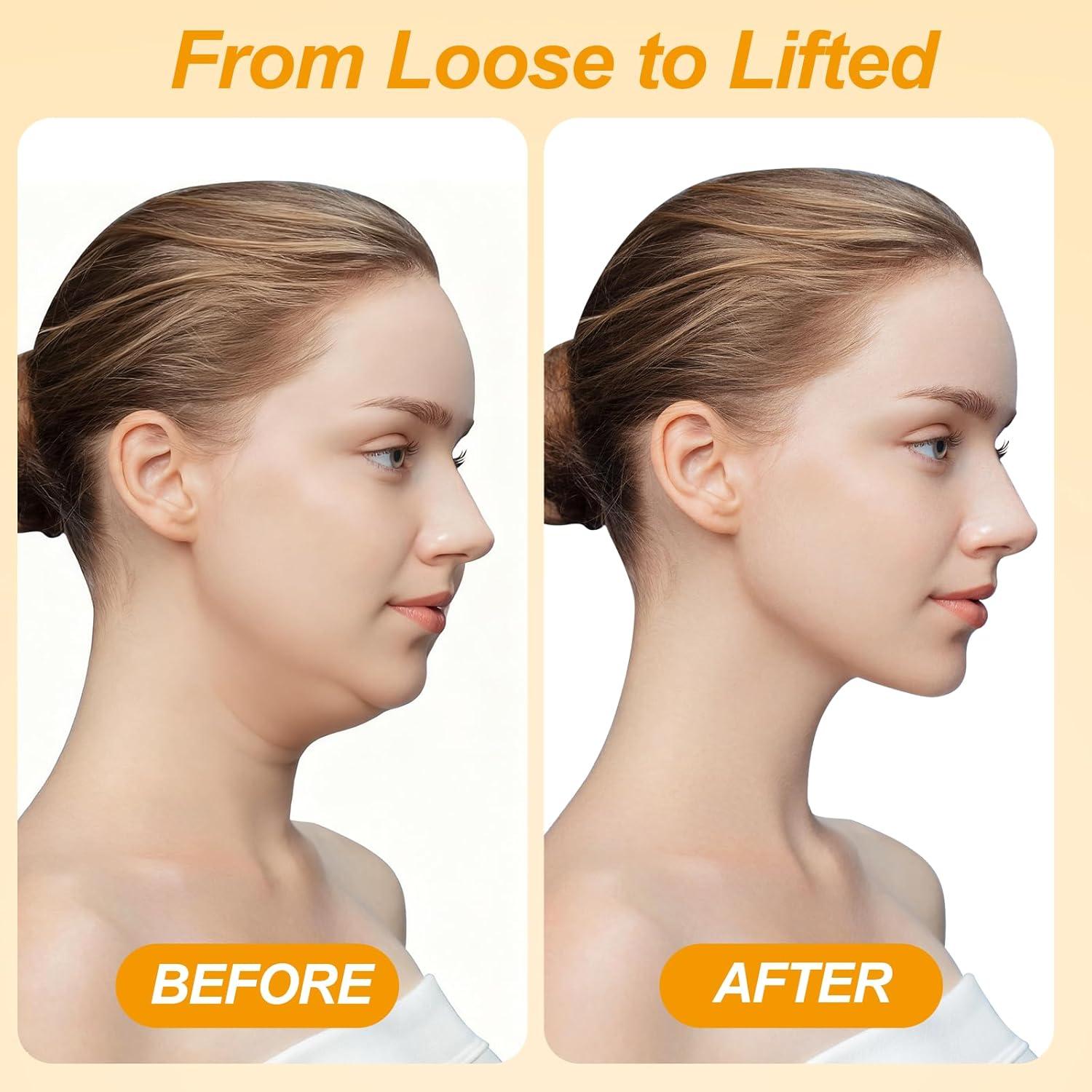 Mascarilla de Levantamiento Facial Racgrul con Almohadilla U