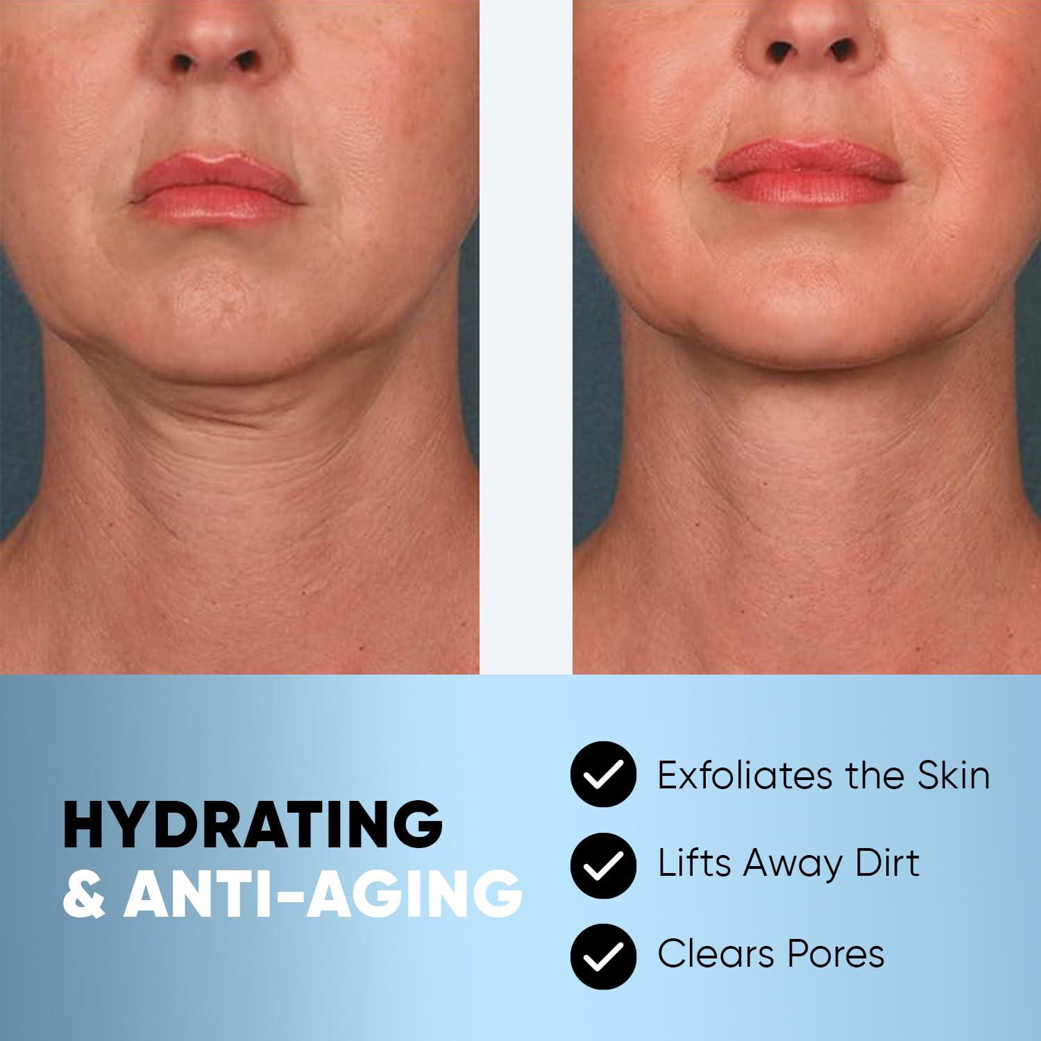 Máscara V Line Reafirmante ESTETIST - Paquete de 5 Unidades