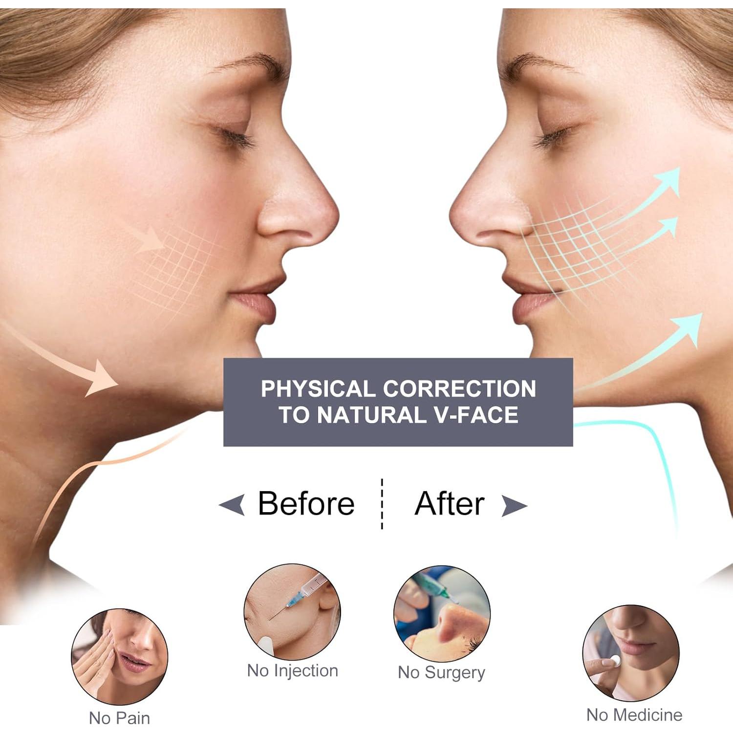 Correa Reductora de Doble Papada Ajustable Unisex - GanZhou