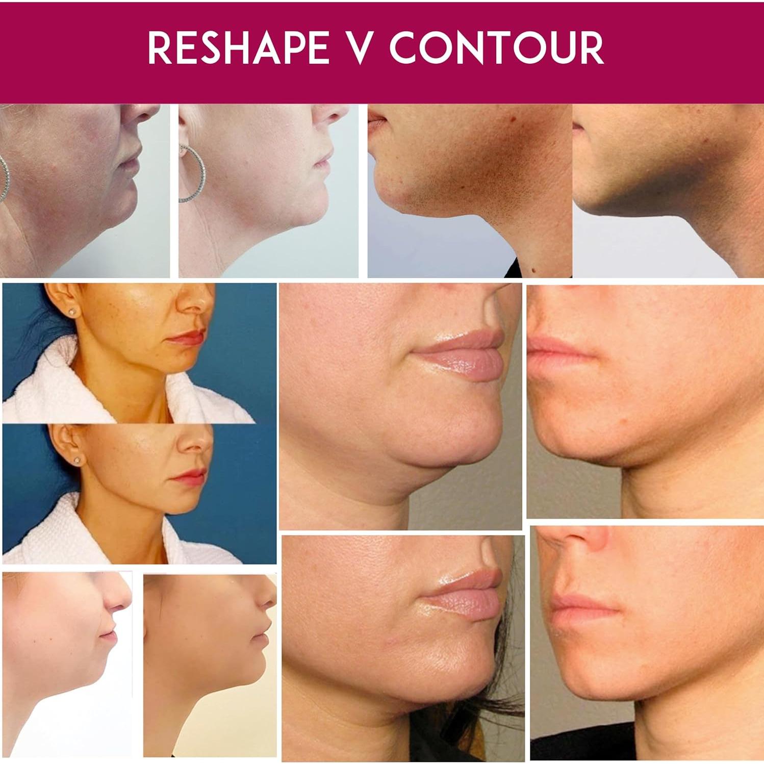 Máscara Reafirmante para Cuello y Barbilla Anacis - 5 Unidades