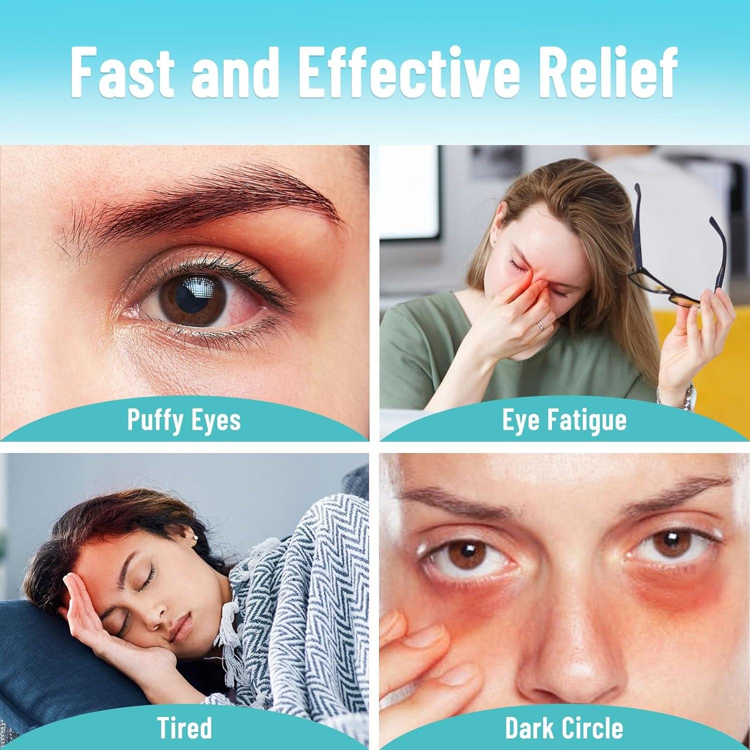 Máscara de Ojos Enfriadora 3D ATreebay - Gel, Ajustable, Azul