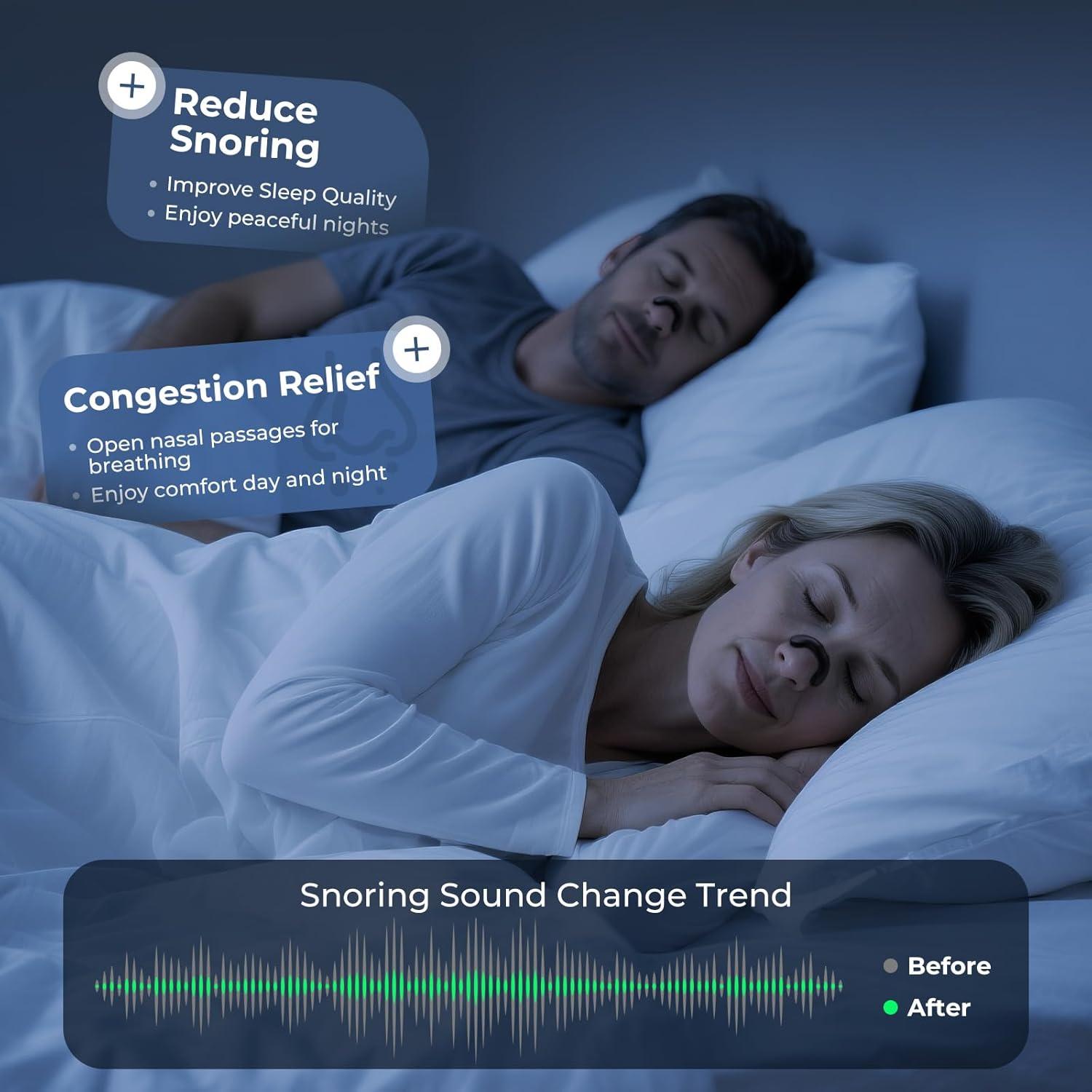 Tiras Nasales Vitgont para Ronquidos - 30 Unidades, Negro